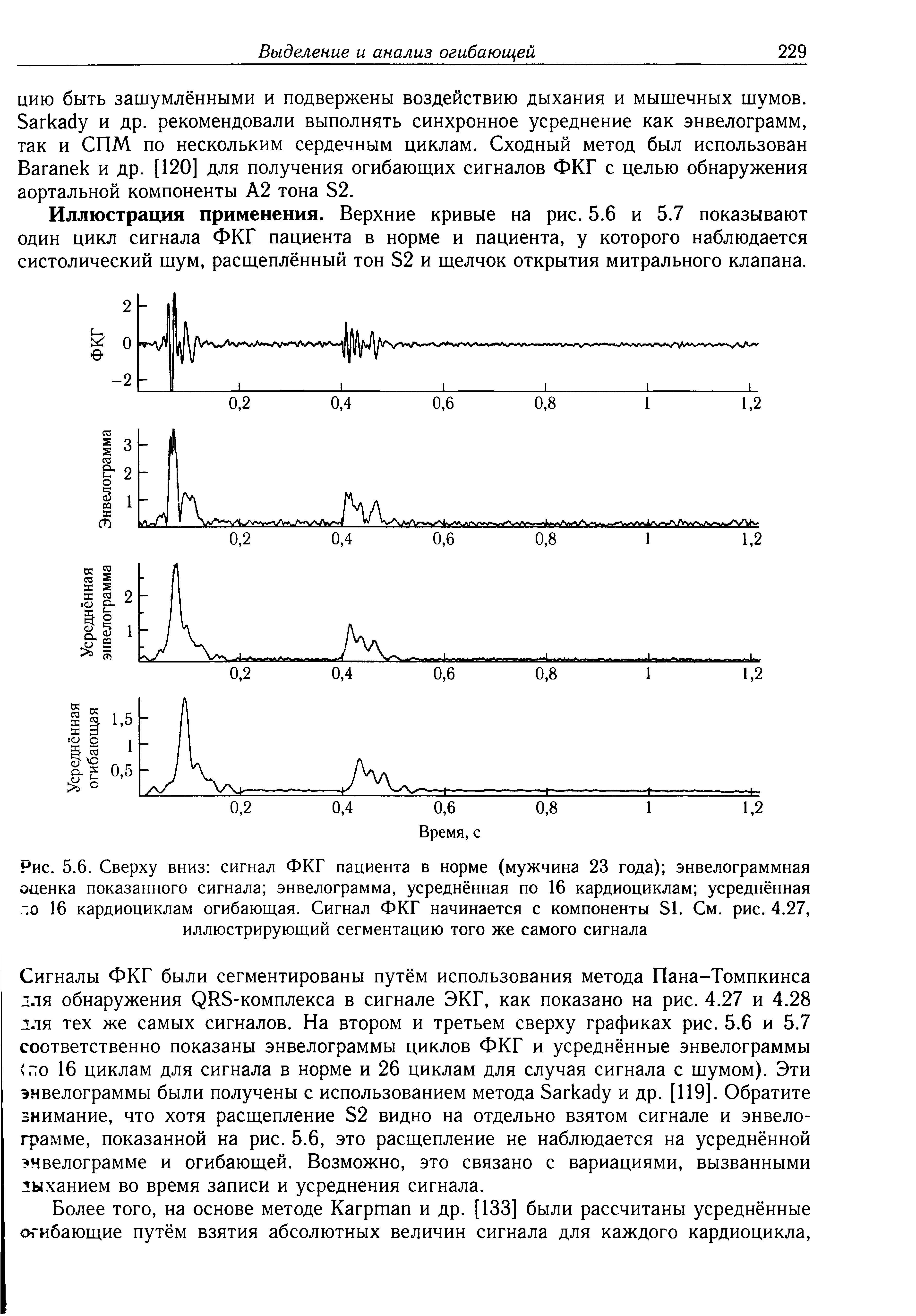 Рис. 5.6. Сверху вниз сигнал ФКГ пациента в норме (мужчина 23 года) энвелограммная оценка показанного сигнала энвелограмма, усреднённая по 16 кардиоциклам усреднённая Ю 16 кардиоциклам огибающая. Сигнал ФКГ начинается с компоненты 51. См. рис. 4.27, иллюстрирующий сегментацию того же самого сигнала...