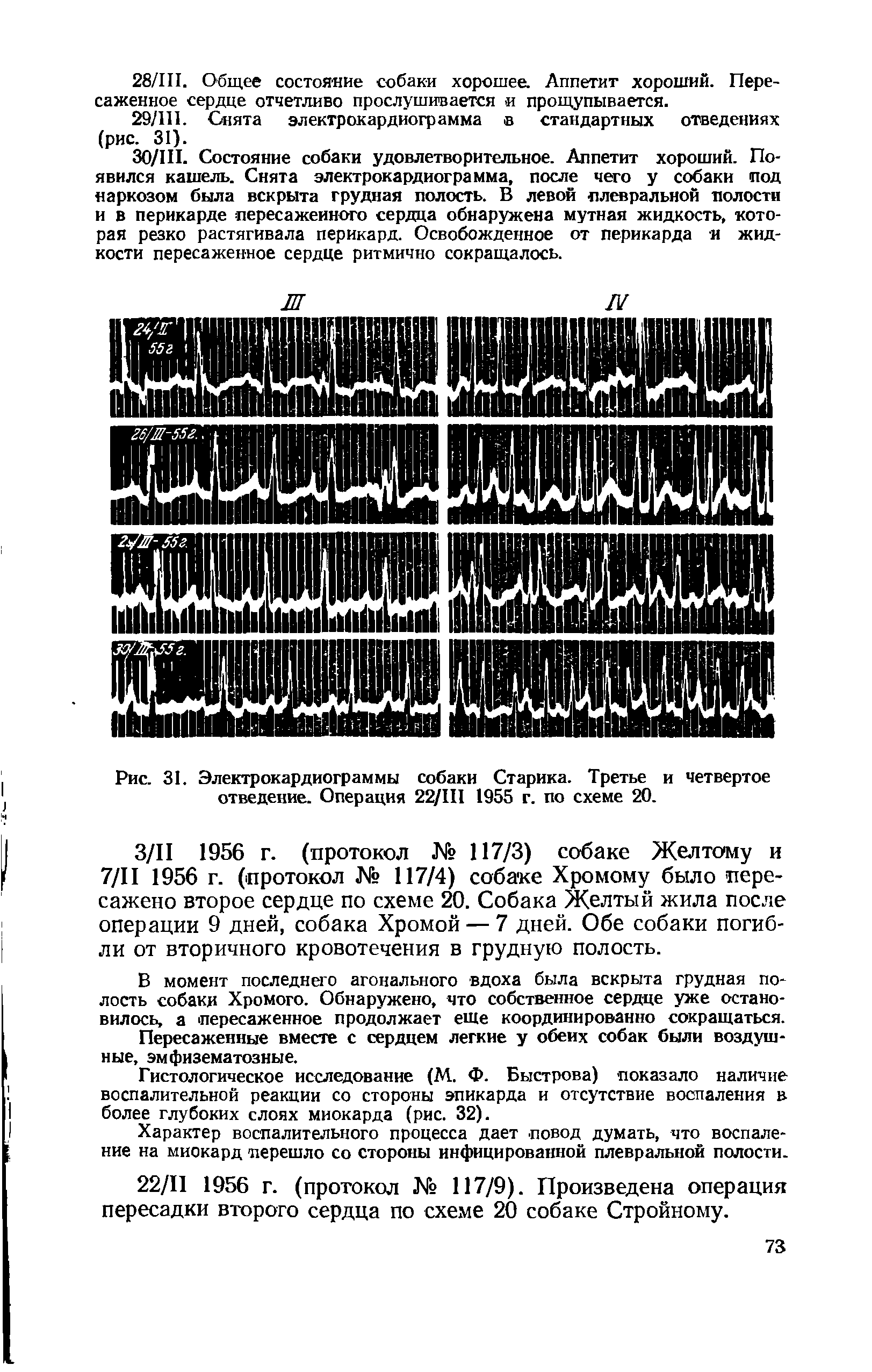 Рис. 31. Электрокардиограммы собаки Старика. Третье и четвертое отведение. Операция 22/Ш 1955 г. по схеме 20.