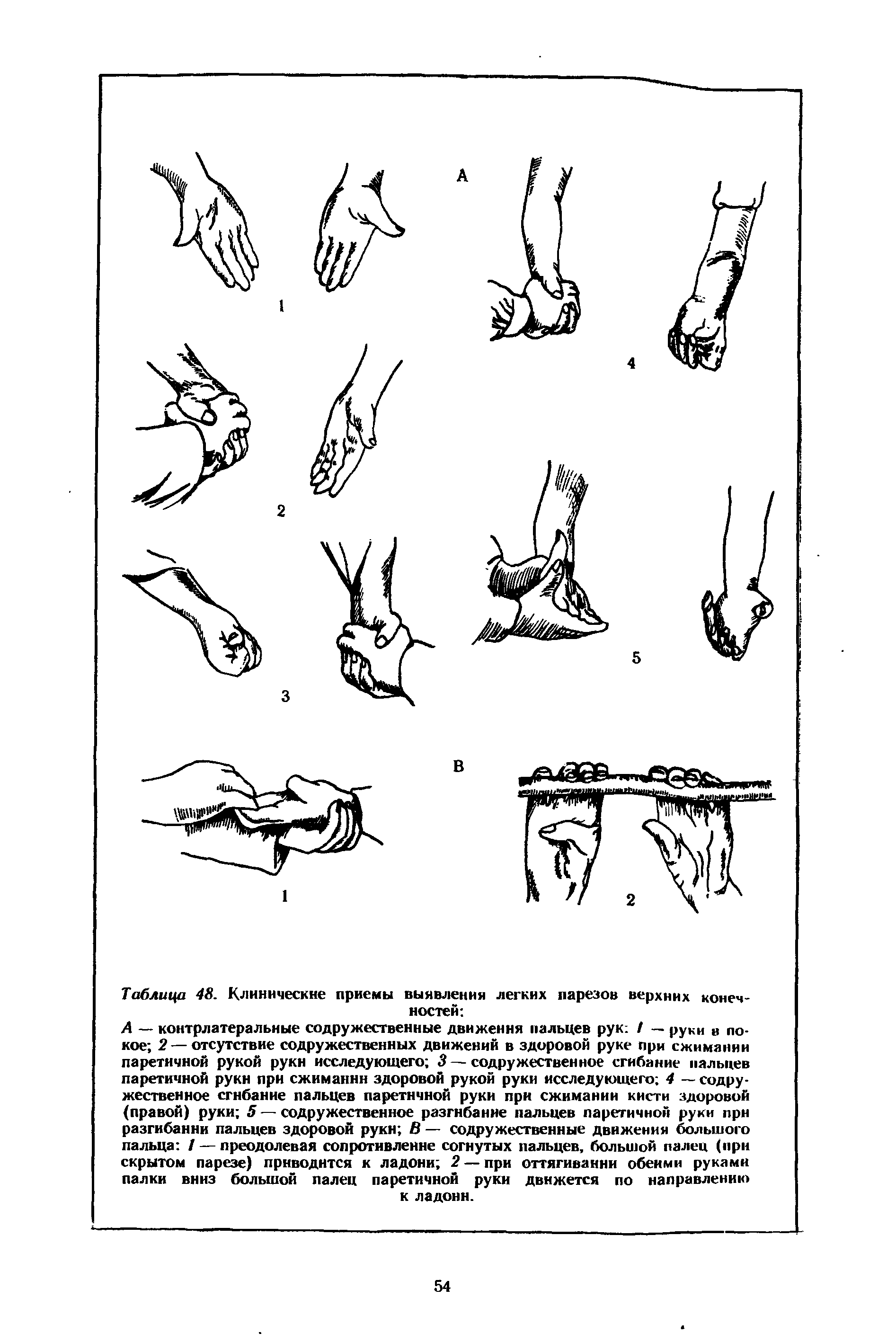 Таблица 48. Клинические приемы выявления легких парезов верхних конечностей ...