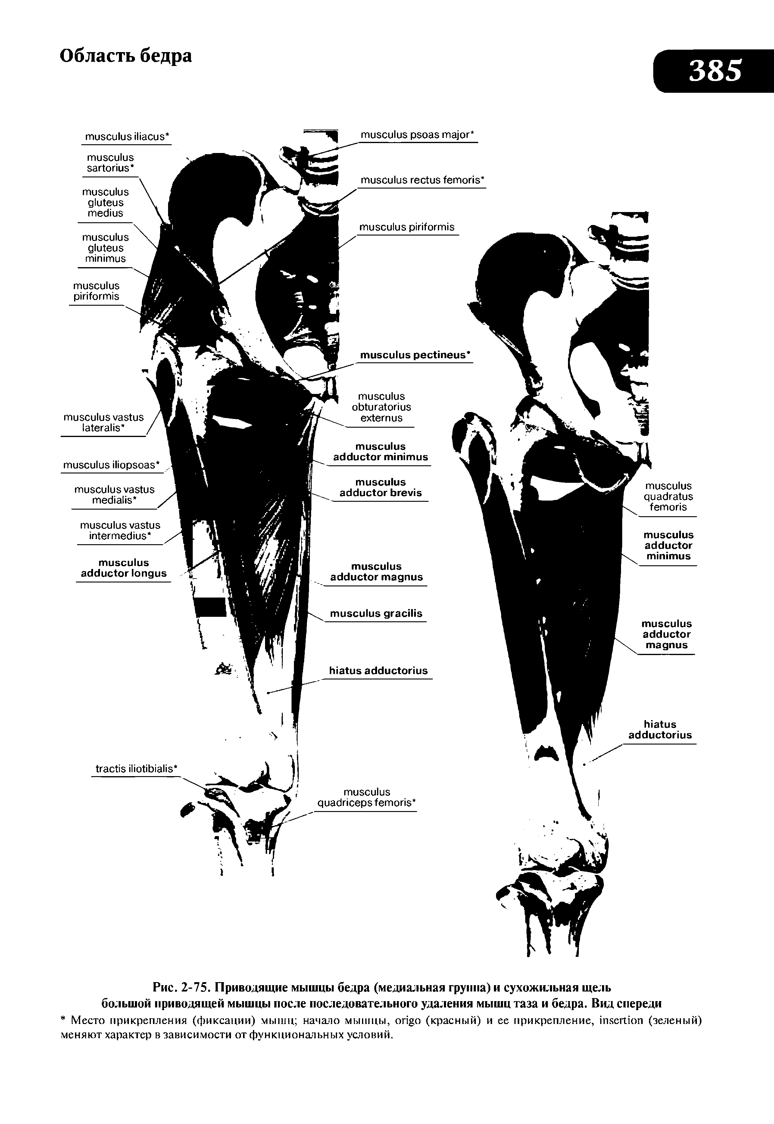 Рис. 2-75. Приводящие мышцы бедра (медиальная группа) и сухожильная щель большой приводящей мышцы после последовательного удаления мышц таза и бедра. Вид спереди...