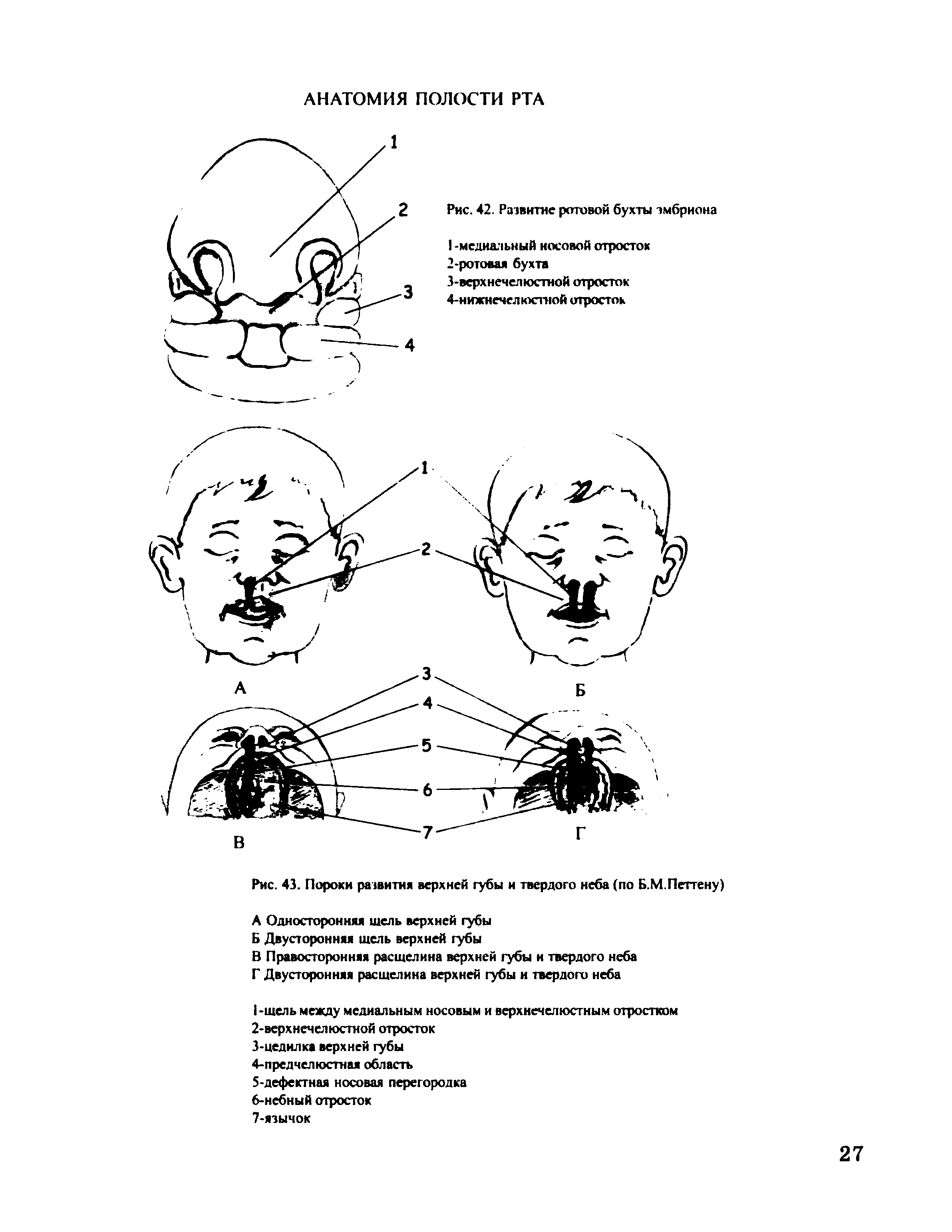 Рис. 43. Пороки развития верхней губы и твердого неба (по Б.М.Петтену)...
