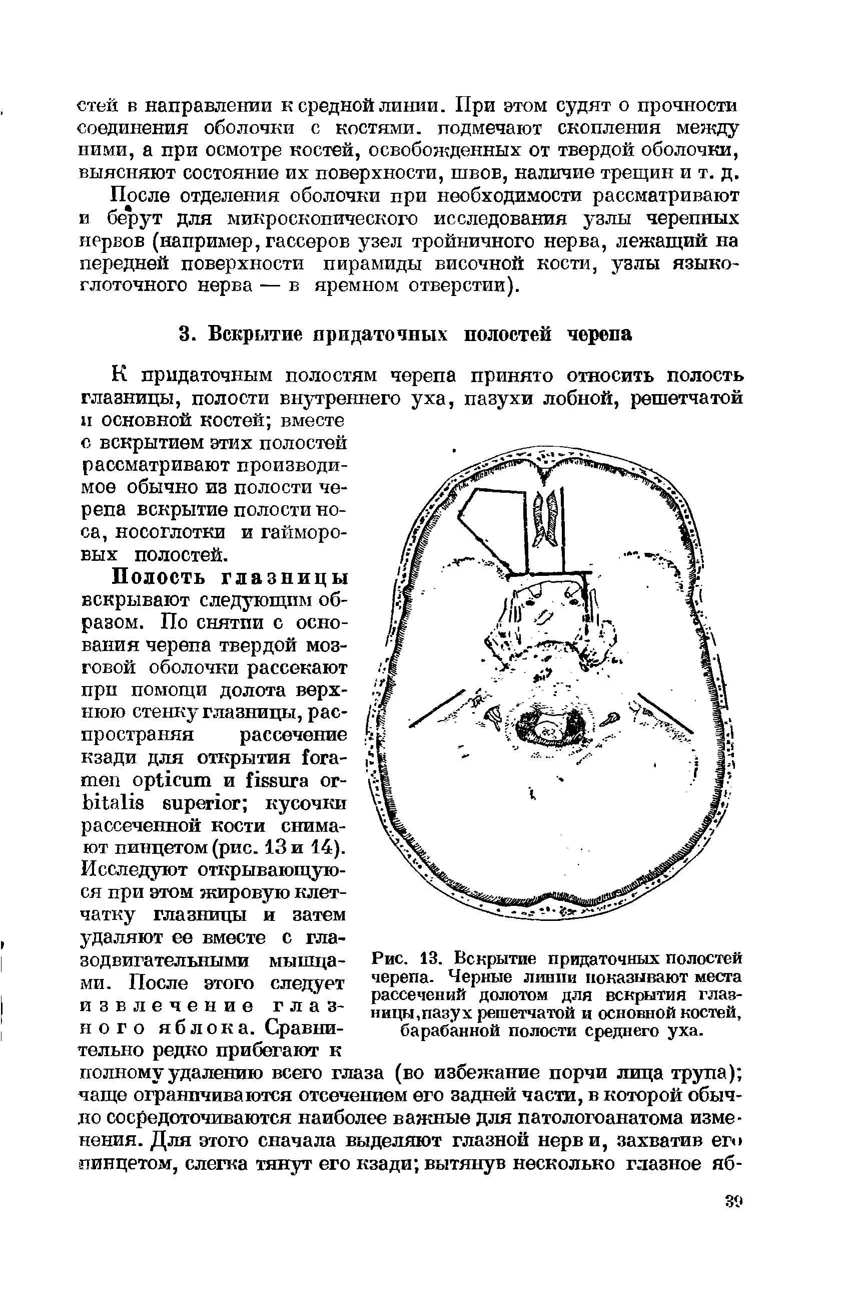 Рис. 13. Вскрытие придаточных полостей черепа. Черные линии показывают места рассечений долотом для вскрытия глазницы,пазух решетчатой и основной костей, барабанной полости среднего уха.