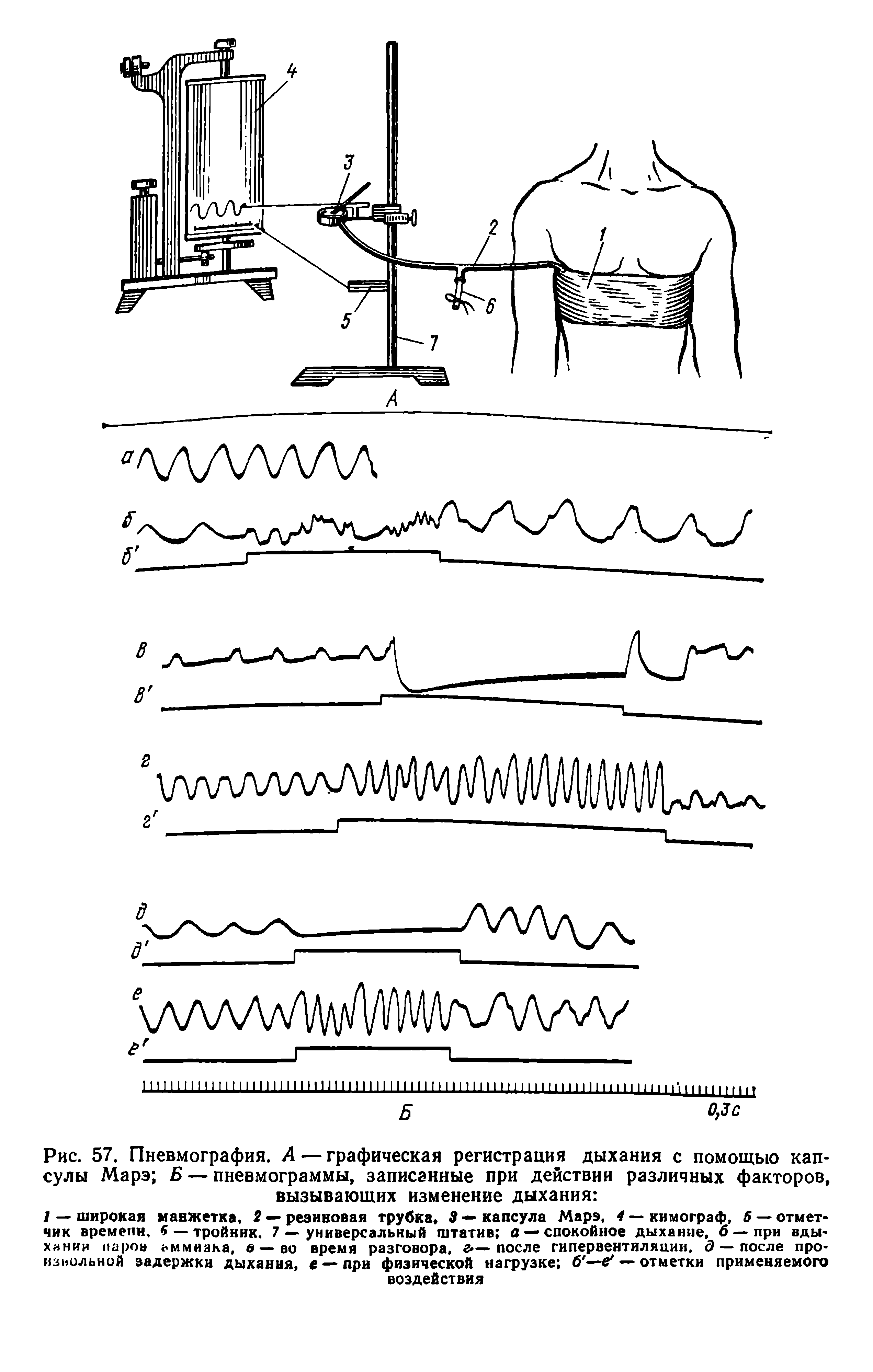 Рис. 57. Пневмография. А — графическая регистрация дыхания с помощью капсулы Марэ Б — пневмограммы, записанные при действии различных факторов, вызывающих изменение дыхания ...
