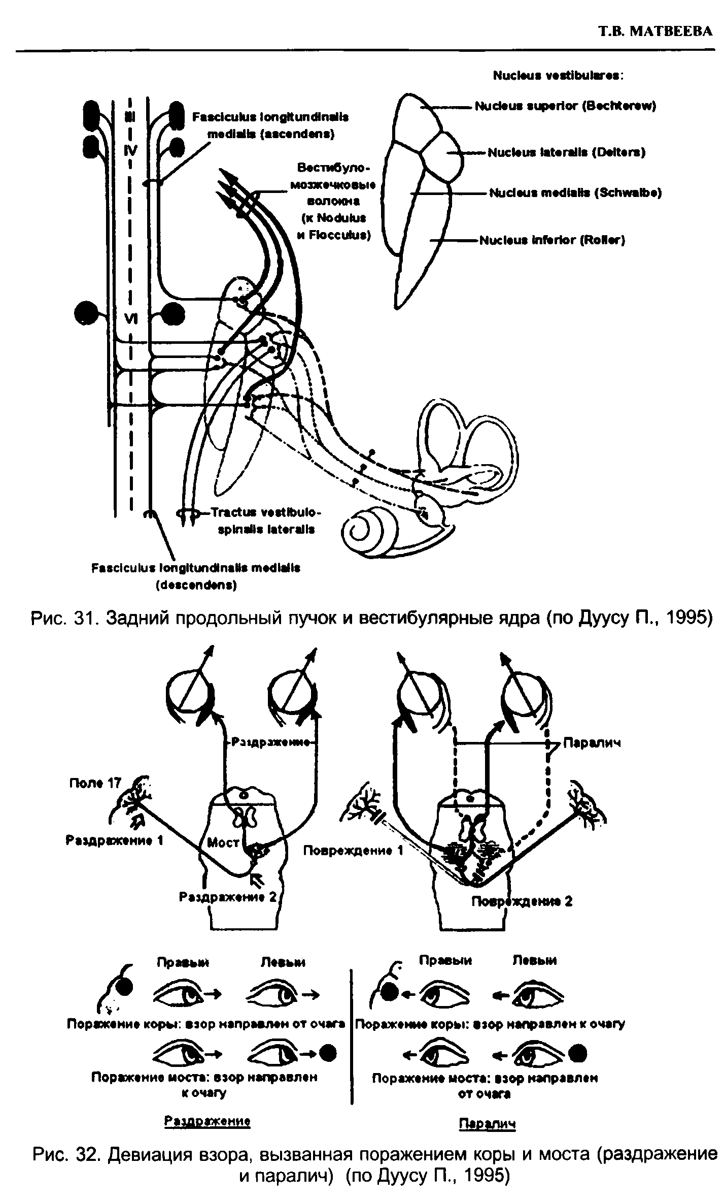 Рис. 31. Задний продольный пучок и вестибулярные ядра (по Дуусу П 1995)...