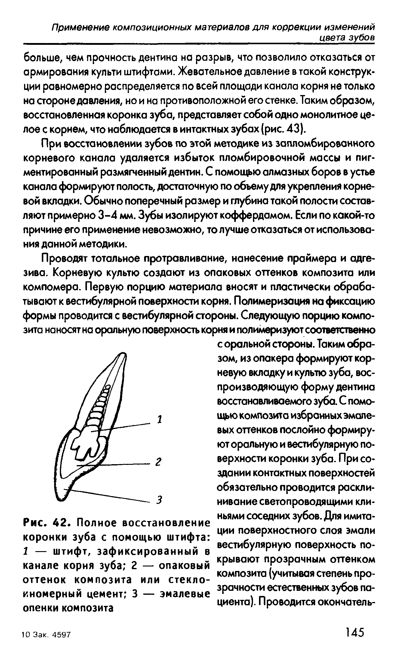 Рис. 42. Полное восстановление коронки зуба с помощью штифта 1 — штифт, зафиксированный в канале корня зуба 2 — опаковый оттенок композита или стекло-иномерный цемент 3 — эмалевые опенки композита...