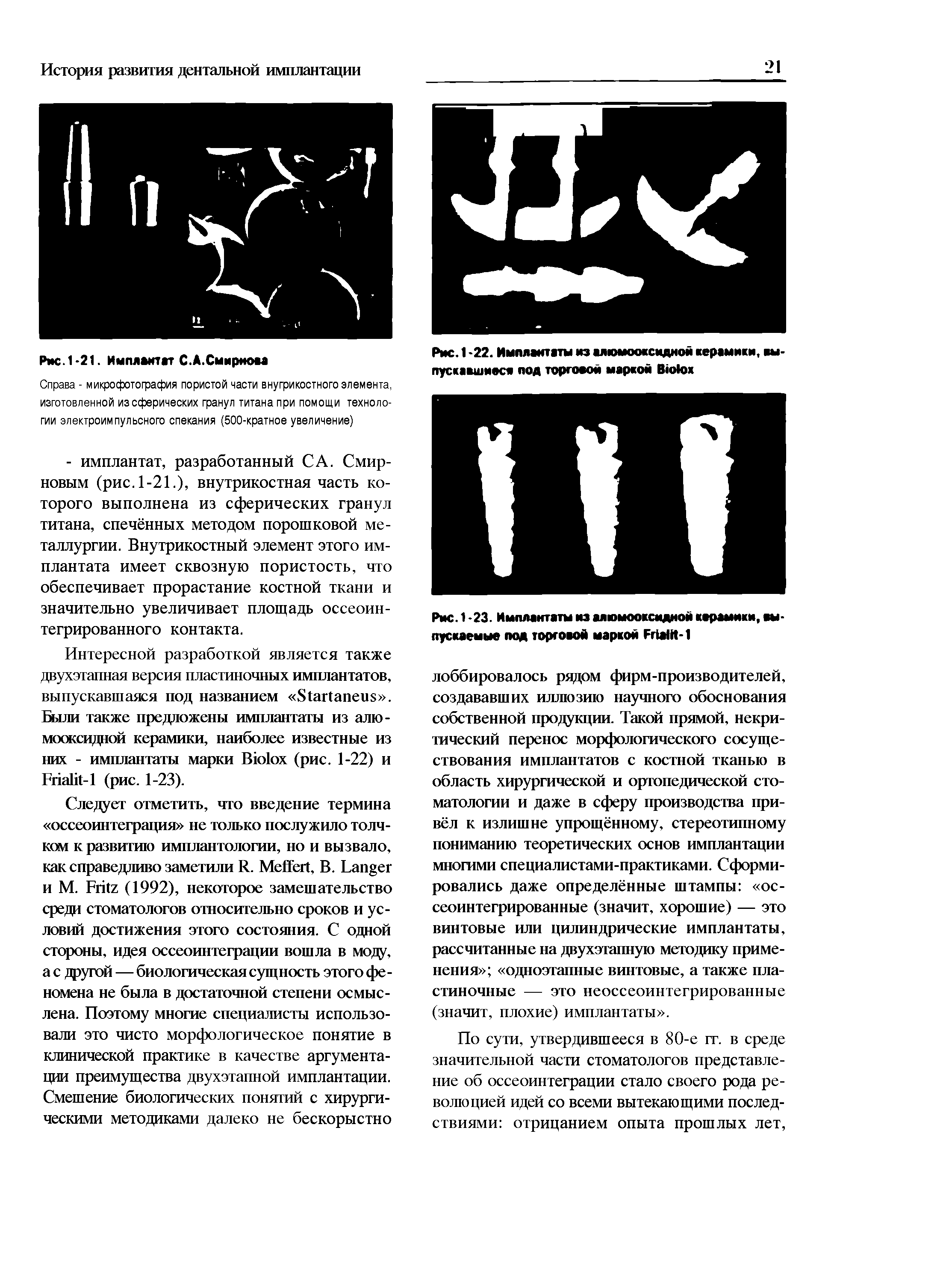 Рис. 1-23. Имплантаты из алюмооксидной керамики, выпускаемые под торговой маркой РгШК-1...