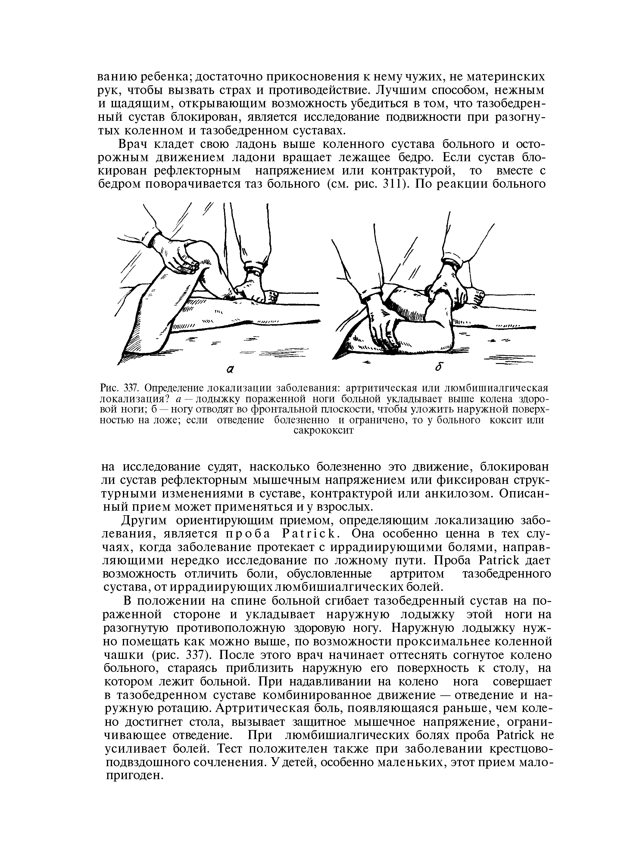 Рис. 337. Определение локализации заболевания артритическая или люмбишиалгическая локализация а — лодыжку пораженной ноги больной укладывает выше колена здоровой ноги б — ногу отводят во фронтальной плоскости, чтобы уложить наружной поверхностью на ложе если отведение болезненно и ограничено, то у больного коксит или сакрококсит...