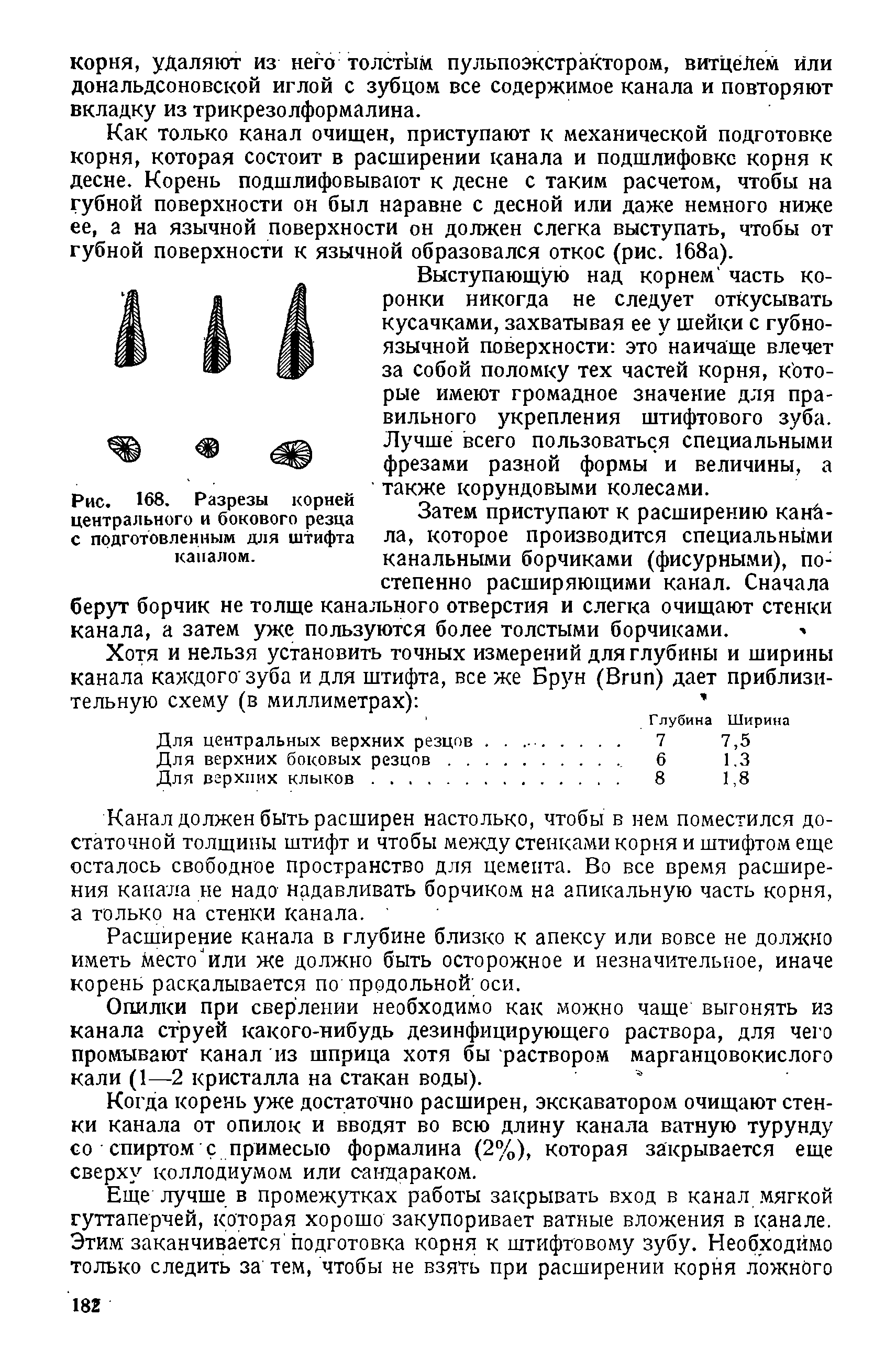 Рис. 168. Разрезы корней центрального и бокового резца с подготовленным для штифта каналом.