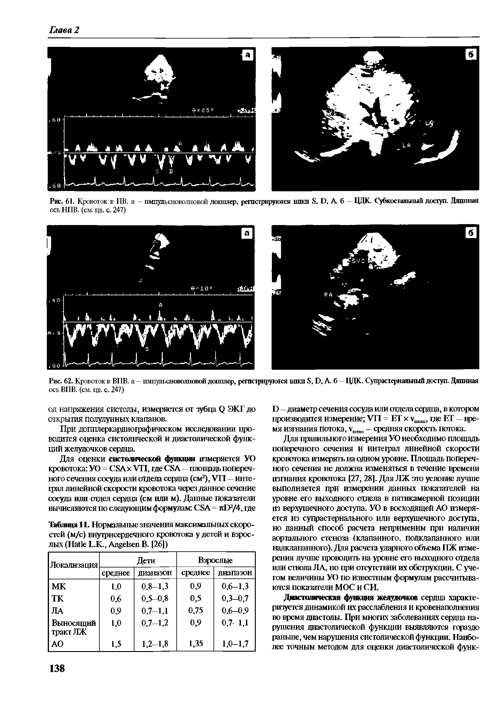 Таблица . Нормальные значения максимальных скоростей (м/с) внутрисердечного кровотока у детей и взрослых (H L.K., A В. [26])...