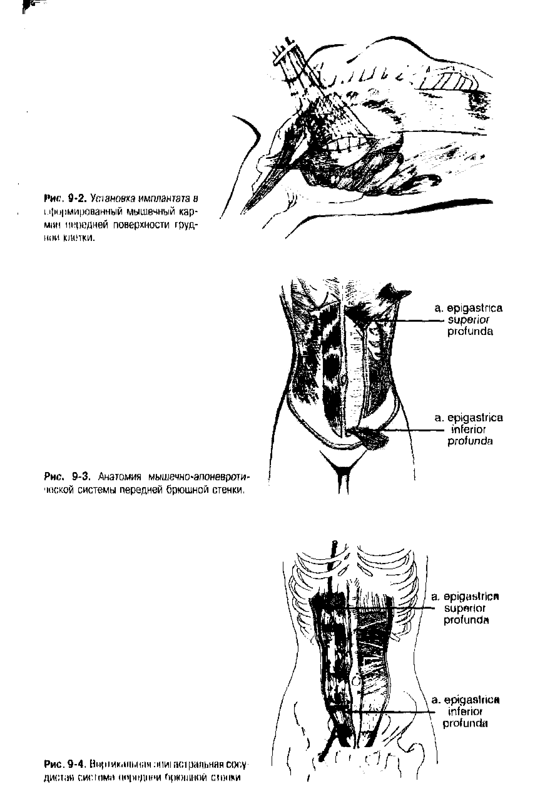 Рис. 9-4. Ннр1ика1. иач и рапьняя сосу дитан сит ими ( <)р1Щ1юи прюшгюй с г пики...