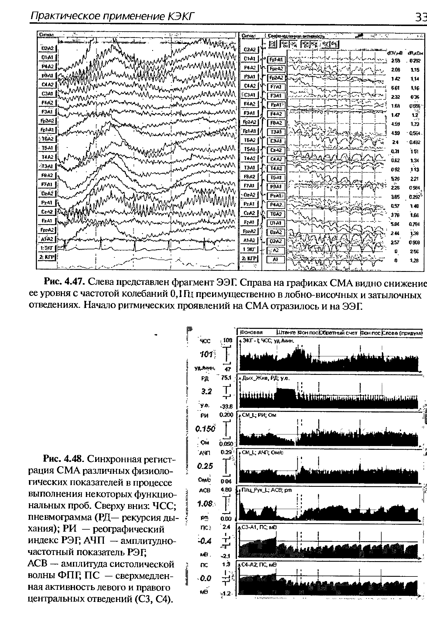 Рис. 4.48. Синхронная регистрация СМА различных физиологических показателей в процессе выполнения некоторых функциональных проб. Сверху вниз ЧСС пневмограмма (РД— рекурсия дыхания) РИ — реографический индекс РЭГ АЧП — амплитудно-частотный показатель РЭГ АСВ — амплитуда систолической волны ФПГ ПС — сверхмедленная активность левого и правого центральных отведений (СЗ, С4).