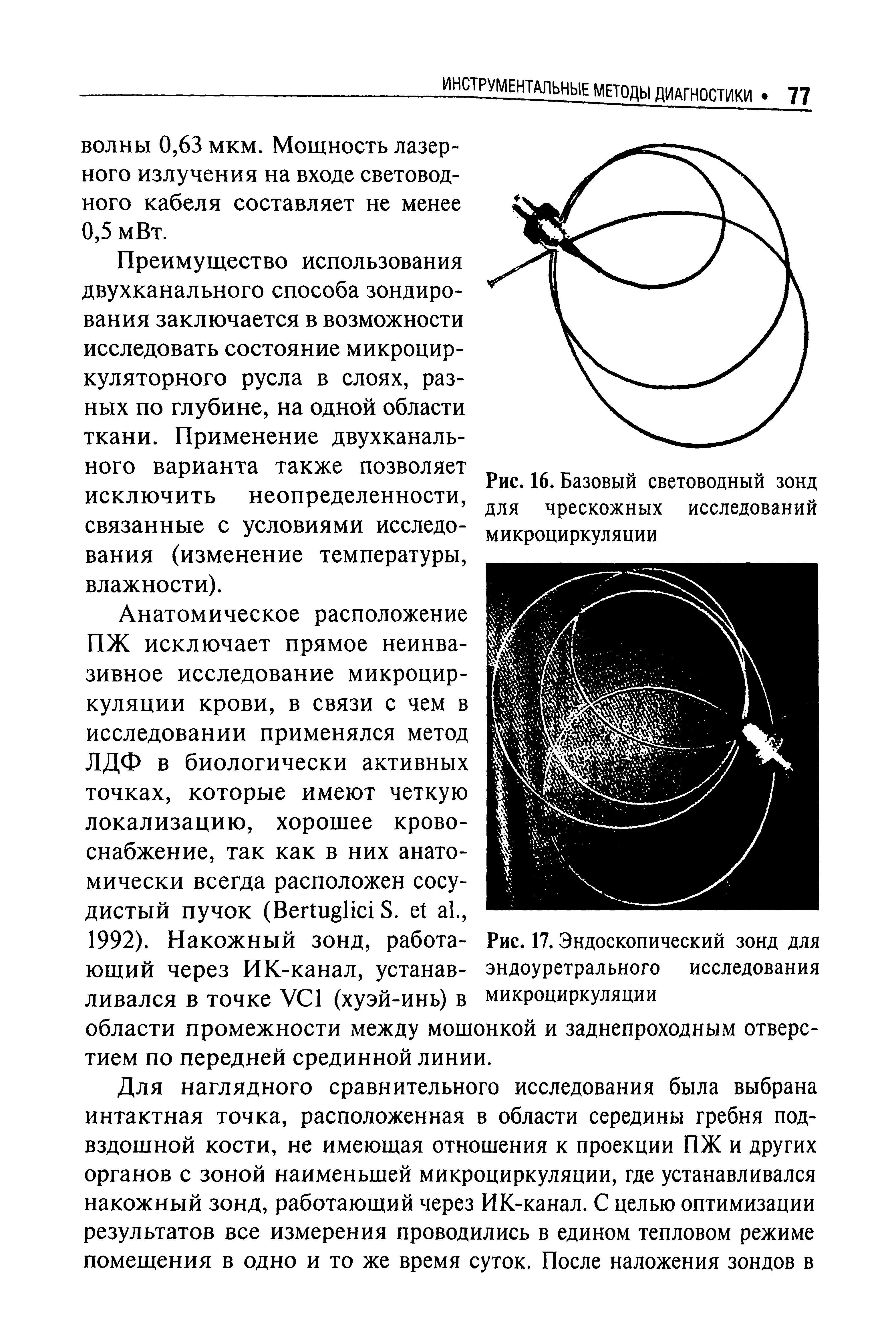 Рис. 16. Базовый световодный зонд для чрескожных исследований микроциркуляции...