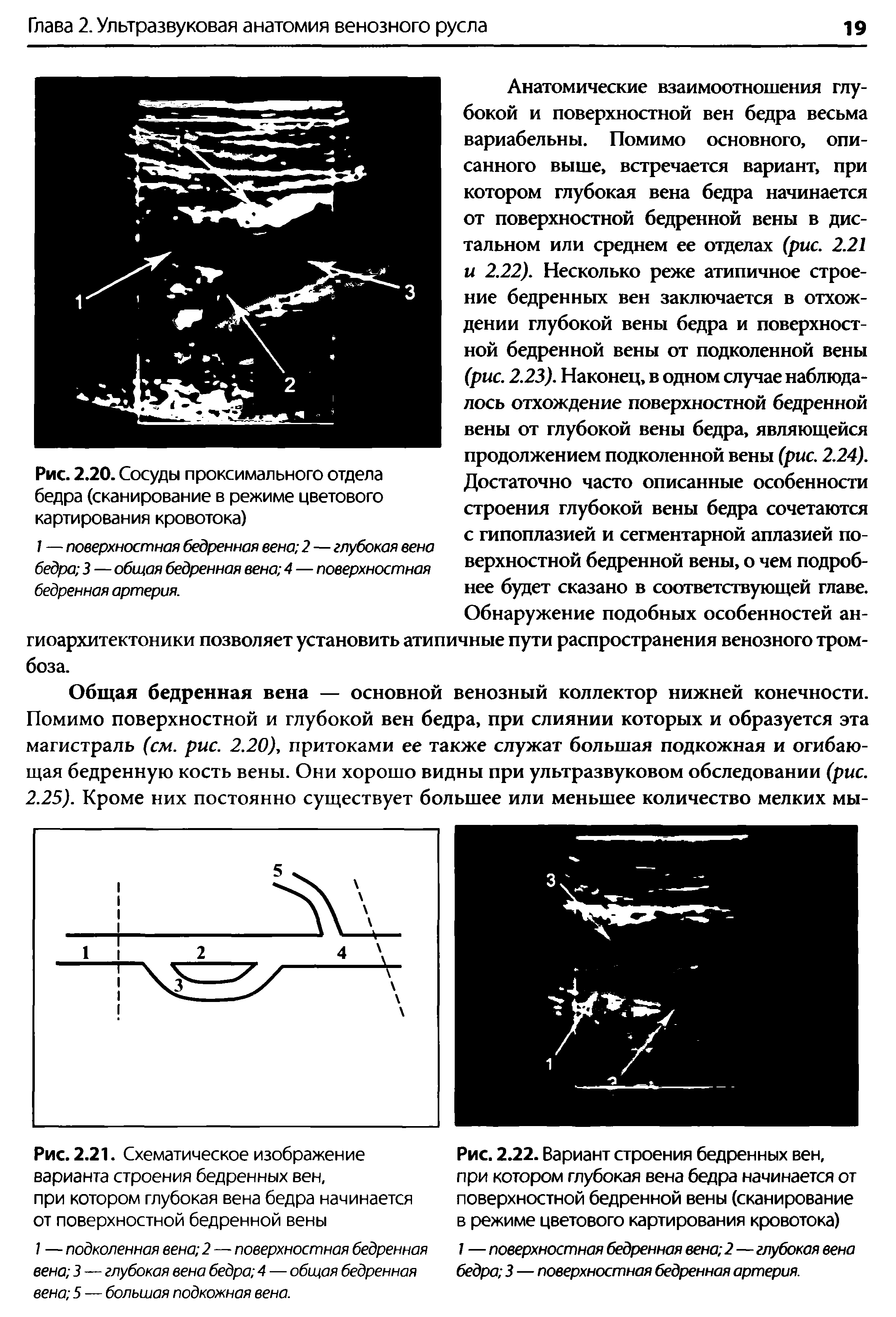 Рис. 2.21. Схематическое изображение варианта строения бедренных вен, при котором глубокая вена бедра начинается от поверхностной бедренной вены...