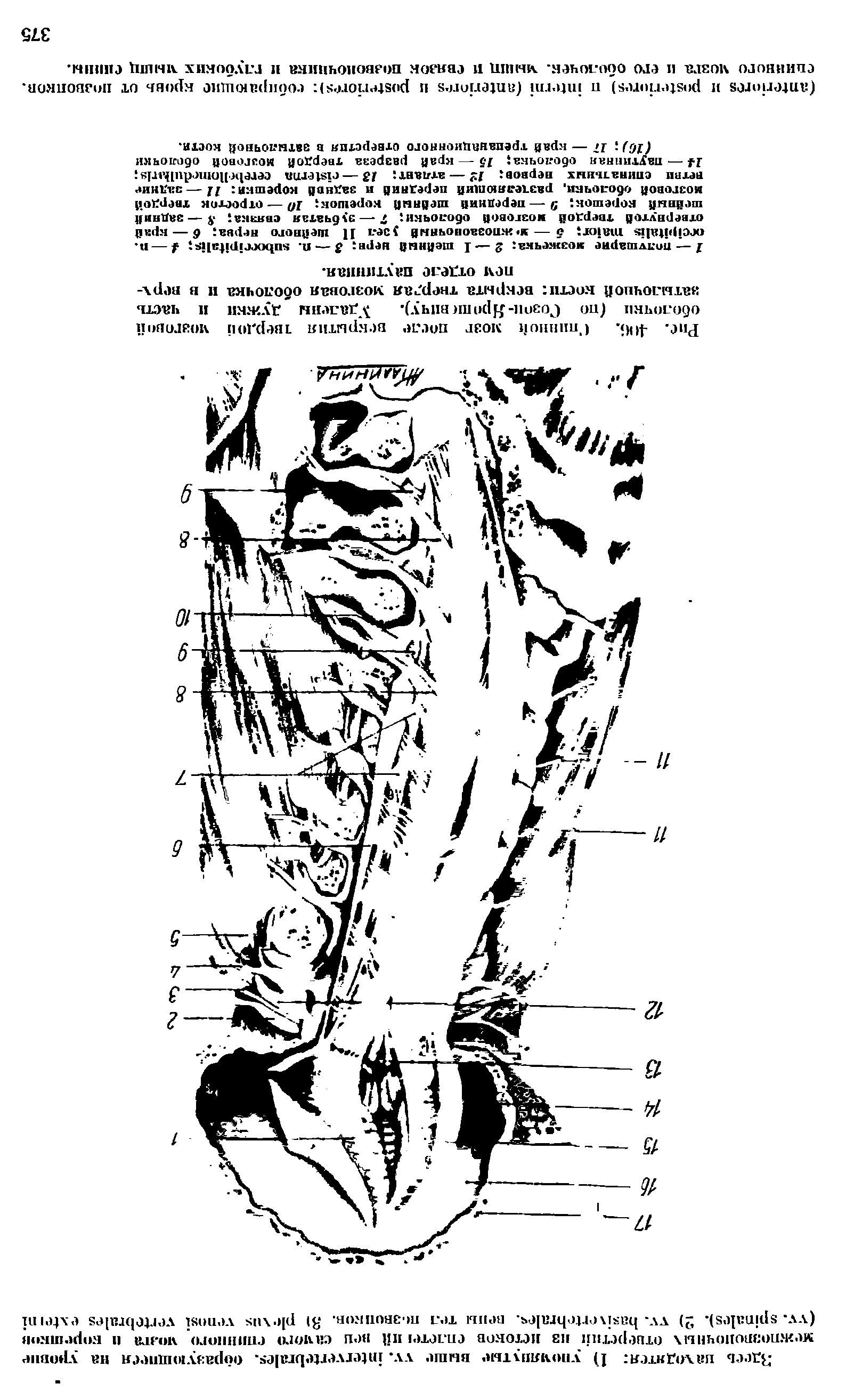 Рис. 4<Н . Спинной мозг после вскрытия твердой мозговой оболочки (по Созои-Яропивпчу). Удалены дужки и часть затылочной кости вскрыта твердая мозговая оболочка и в верх-пем отделе паутинная.