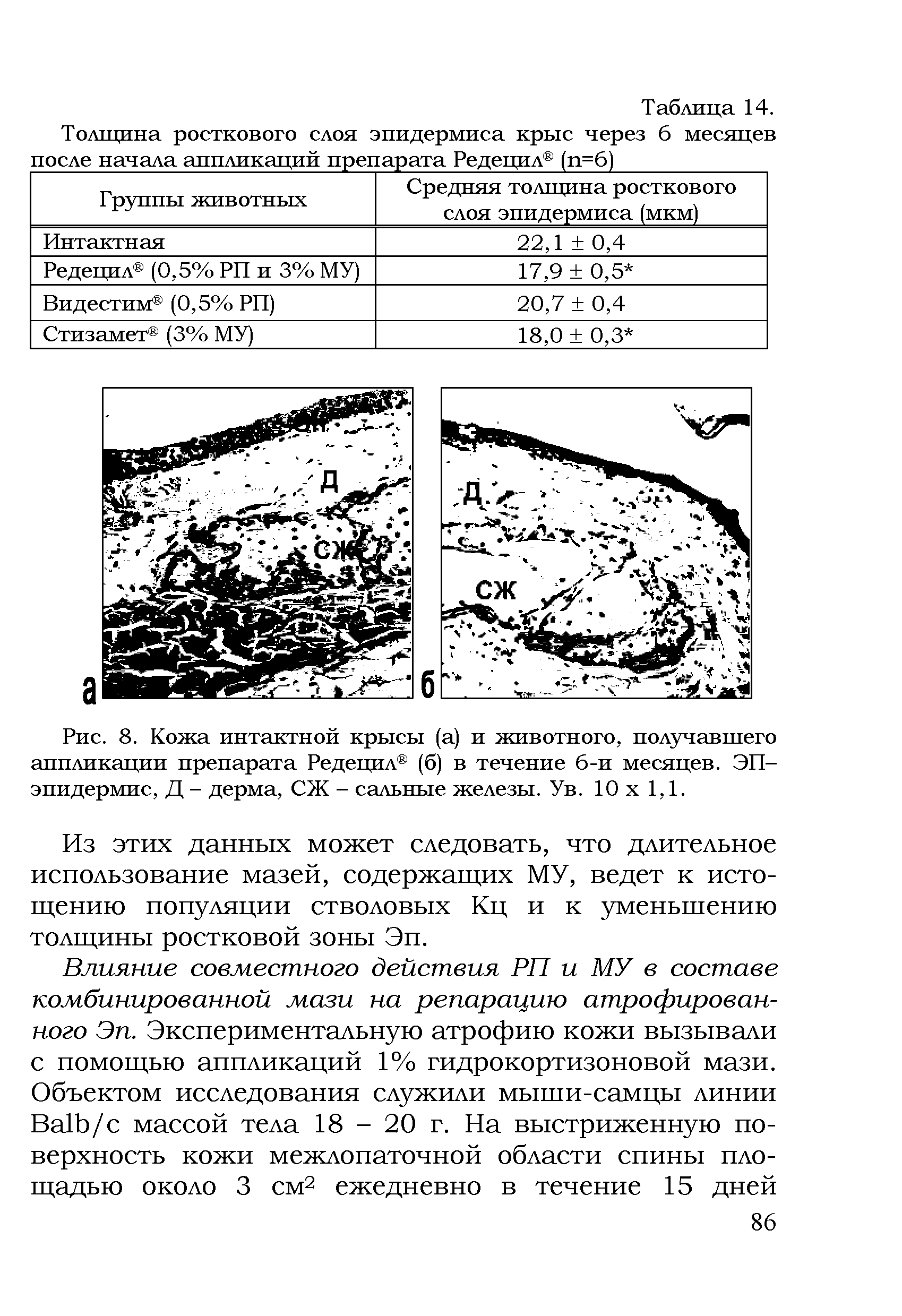 Рис. 8. Кожа интактной крысы (а) и животного, получавшего аппликации препарата Редецил (б) в течение б-и месяцев. ЭП-эпидермис, Д - дерма, СЖ - сальные железы. Ув. 10 х 1,1.