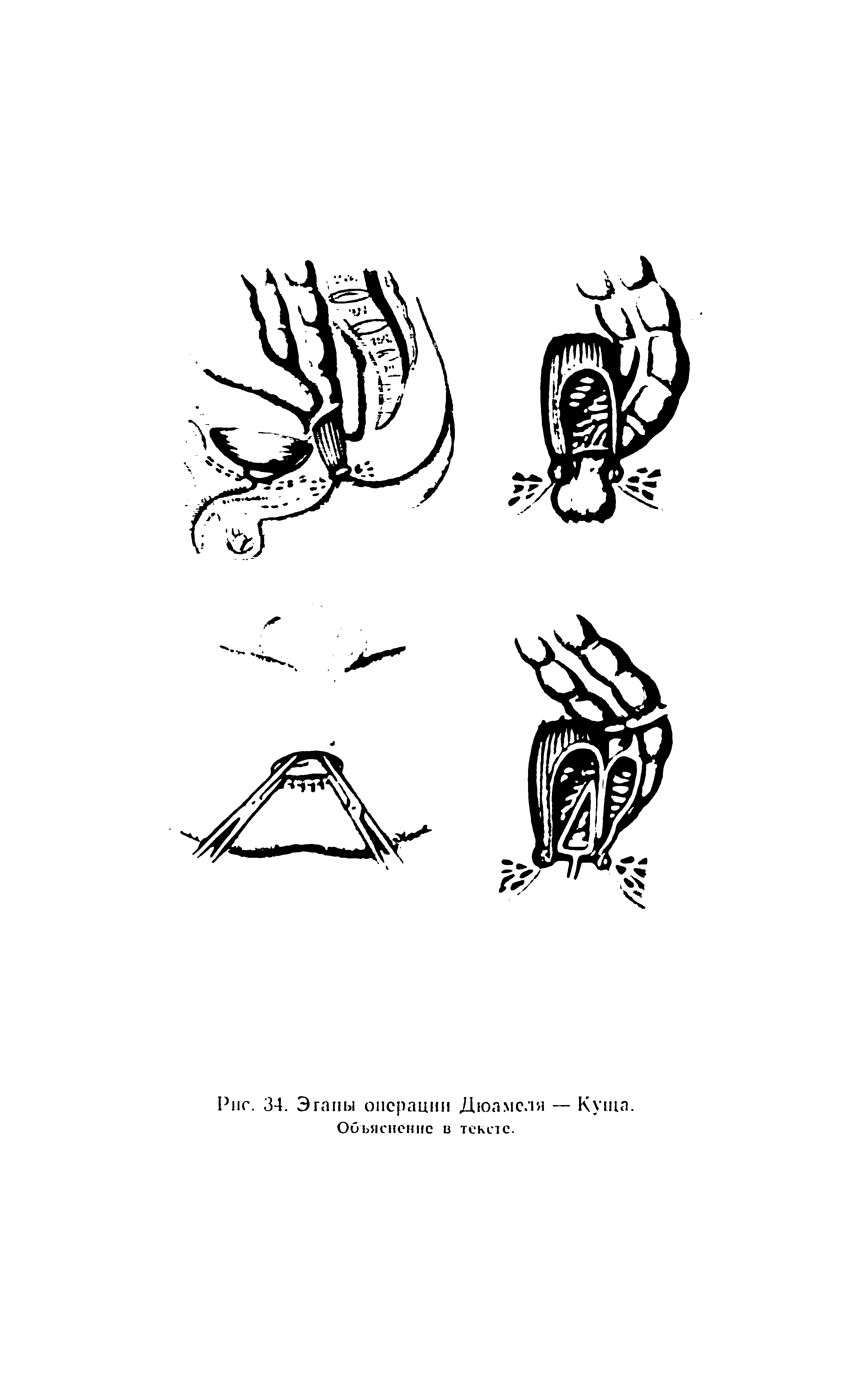 Рис. 34. Эганы операции Дюамеля — Куща. Оиьясненнс в тексте.