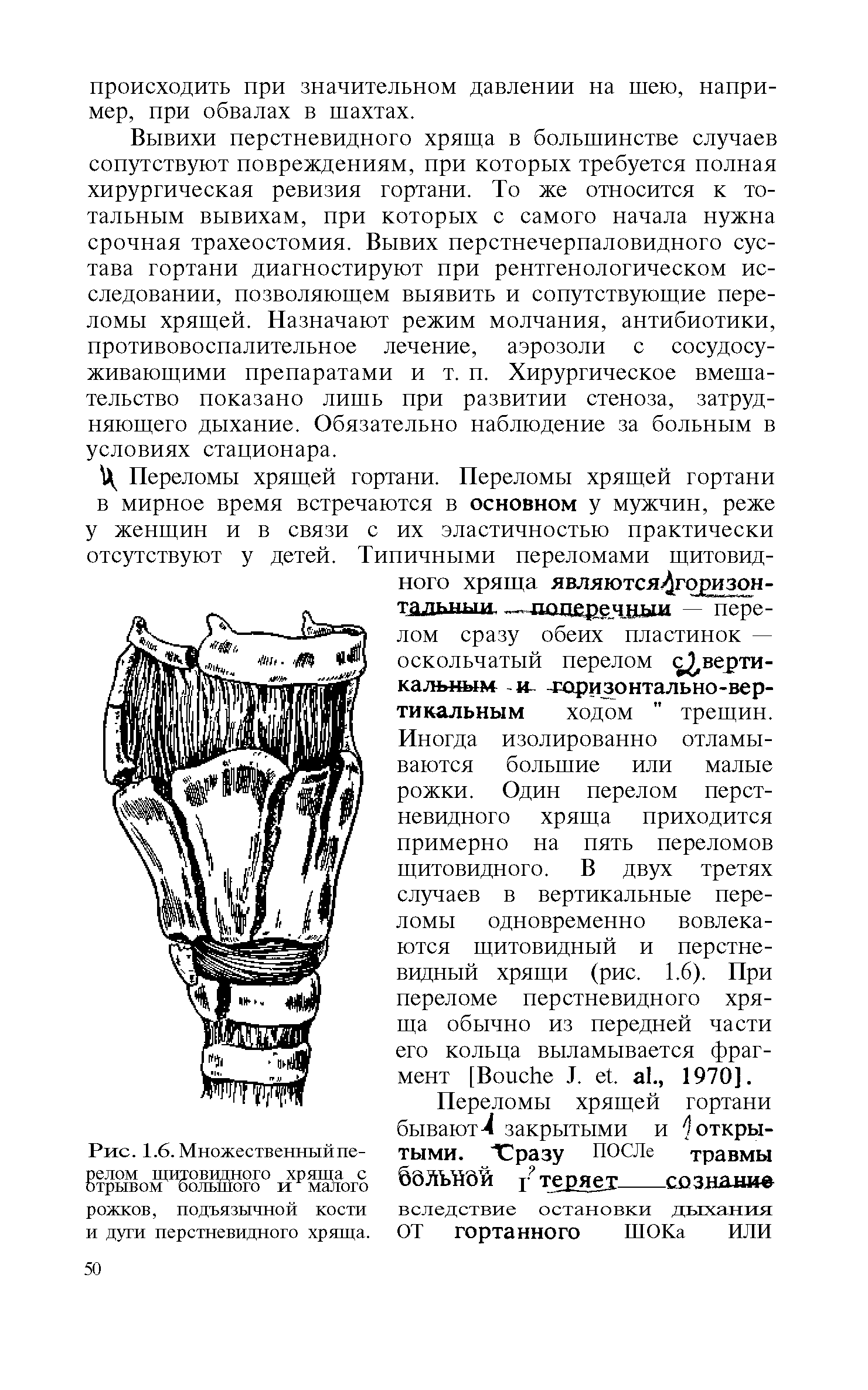 Рис. 1.6. Множественный перелом щитовидного хряща с отрывом большого и малого рожков, подъязычной кости и дуги перстневидного хряща.