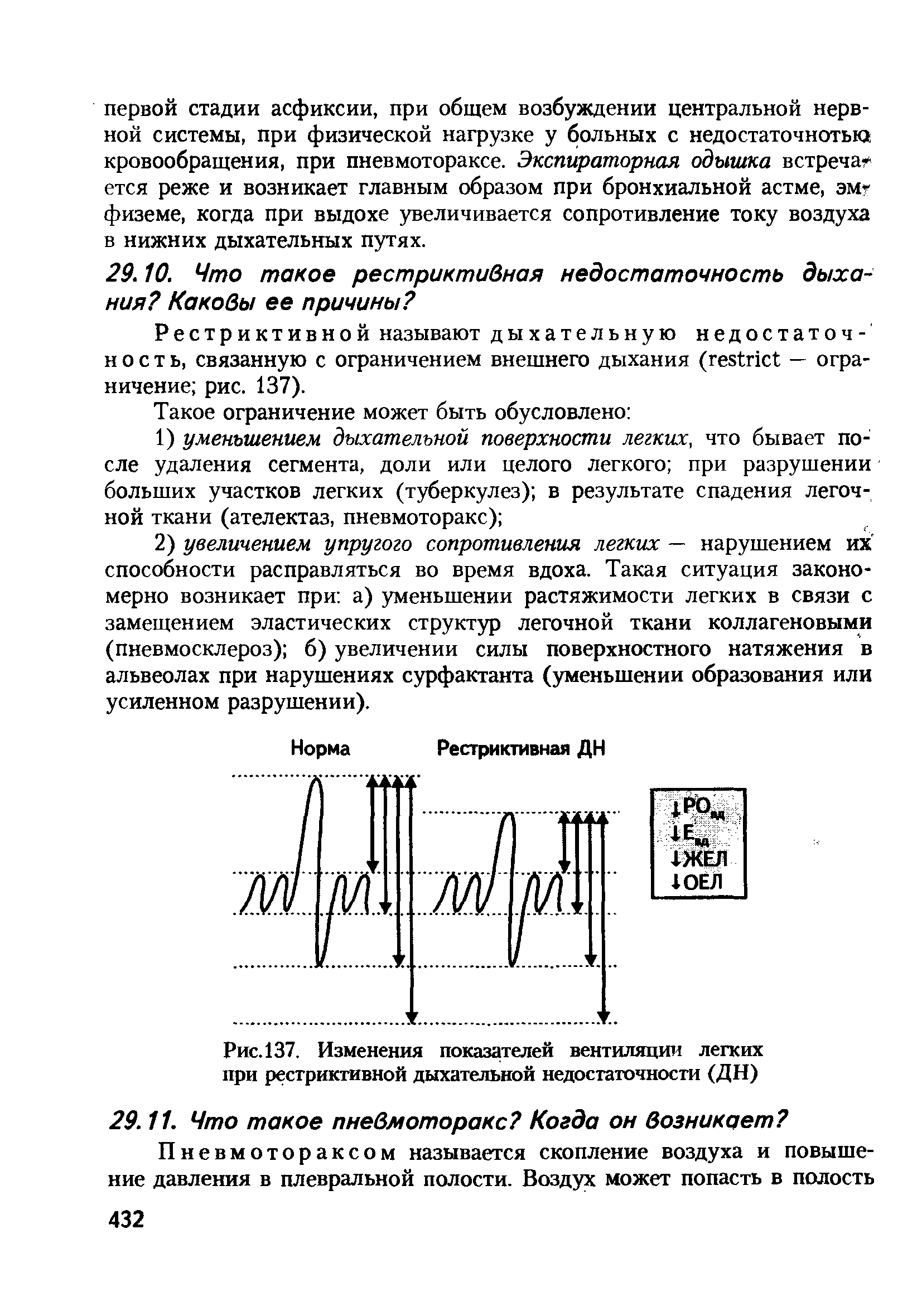 Рис. 137. Изменения показателей вентиляции легких при рестриктивной дыхательной недостаточности (ДН)...