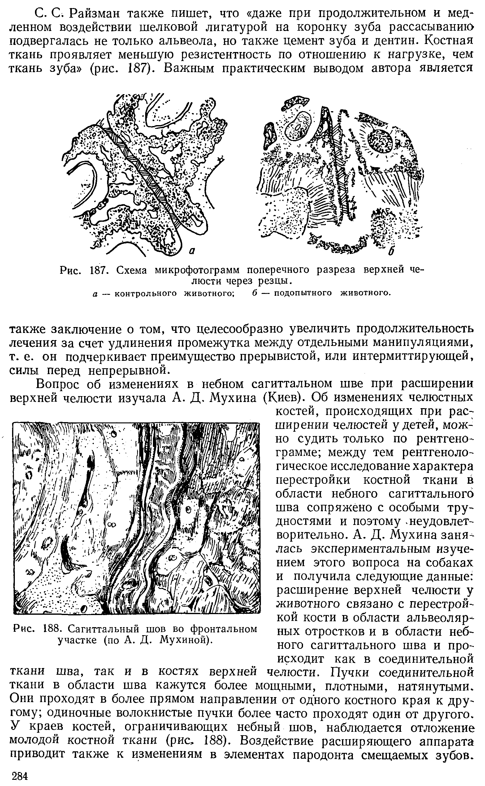 Рис. 187. Схема микрофотограмм поперечного разреза верхней челюсти через резцы.