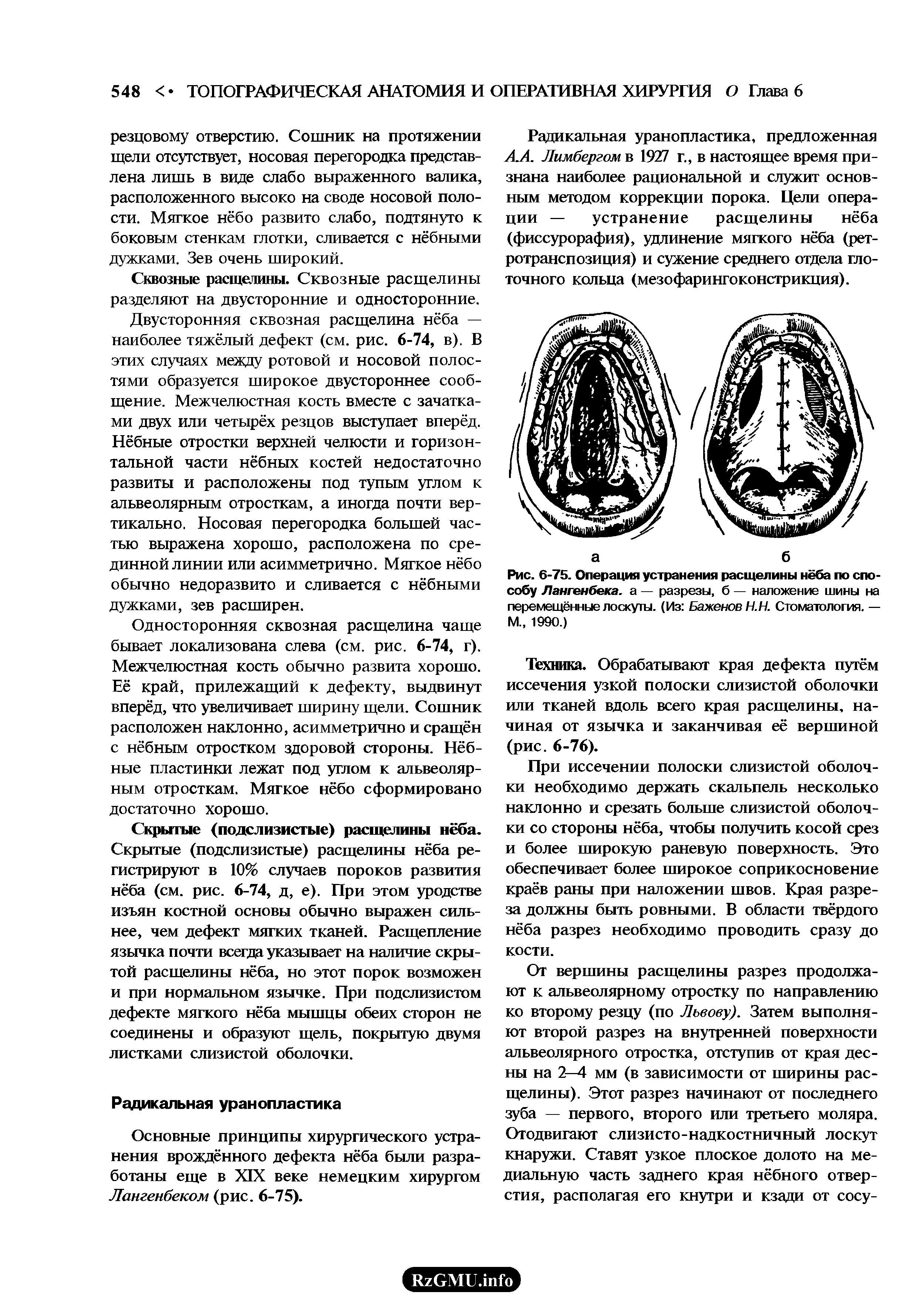 Рис. 6-75. Операция устранения расщелины нёба по способу Лангенбека. а — разрезы, б — наложение шины на перемещённые лоскуты. (Из Баженов Н.Н. Стоматология. — М 1990.)...