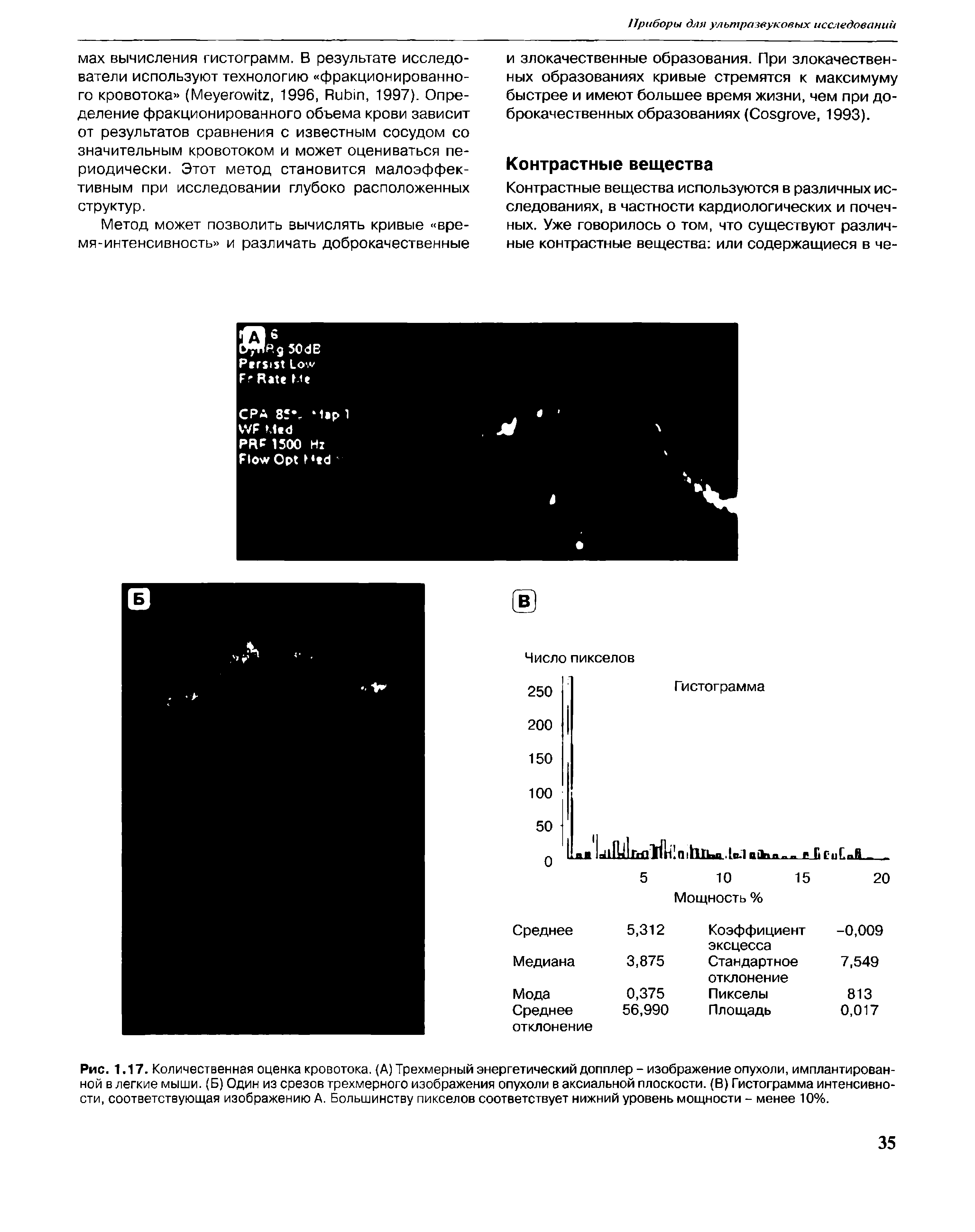 Рис. 1.17. Количественная оценка кровотока. (А) Трехмерный энергетический допплер - изображение опухоли, имплантированной в легкие мыши. (Б) Один из срезов трехмерного изображения опухоли в аксиальной плоскости. (В) Гистограмма интенсивности, соответствующая изображению А. Большинству пикселов соответствует нижний уровень мощности - менее 10%.