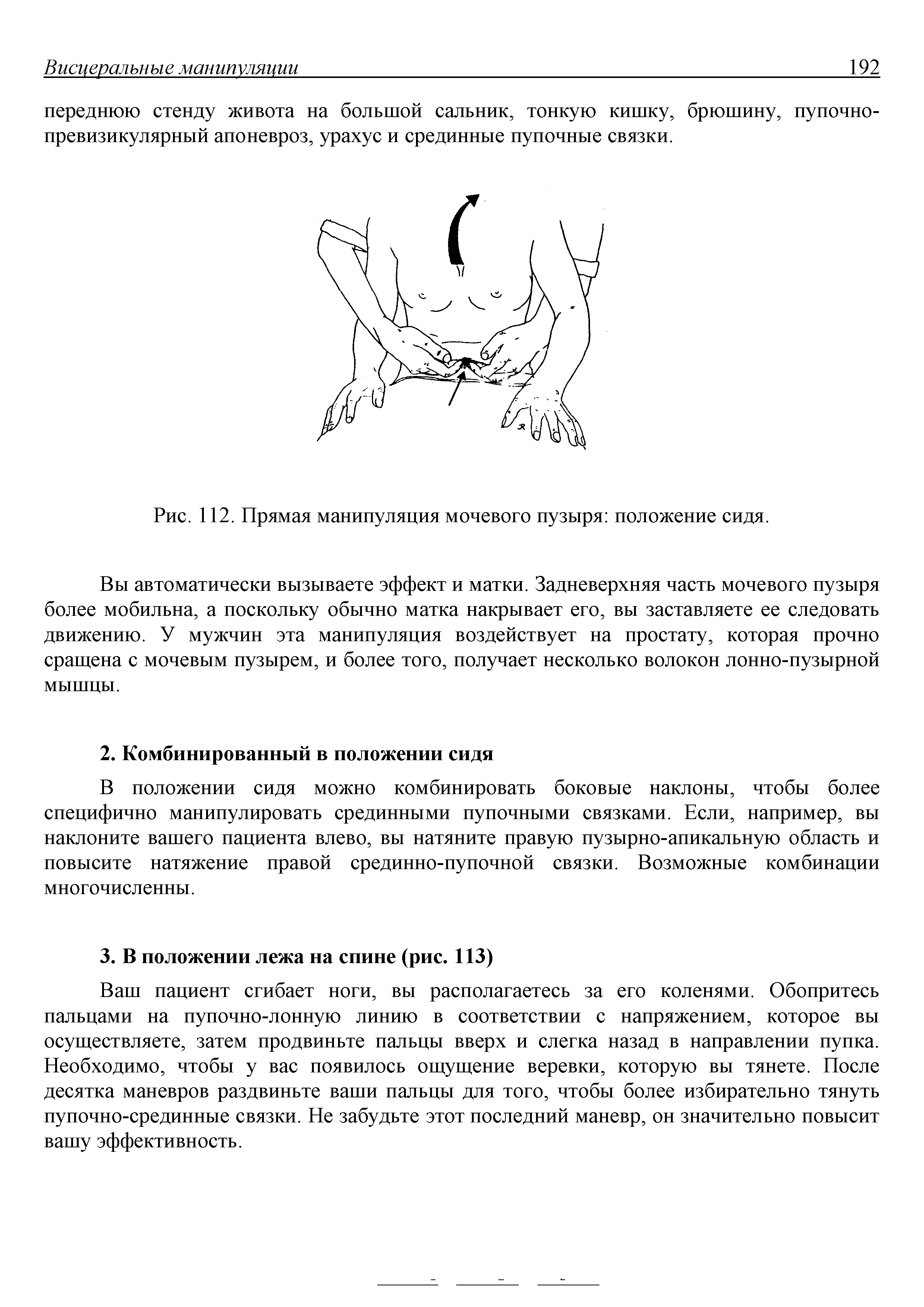 Рис. 112. Прямая манипуляция мочевого пузыря положение сидя.