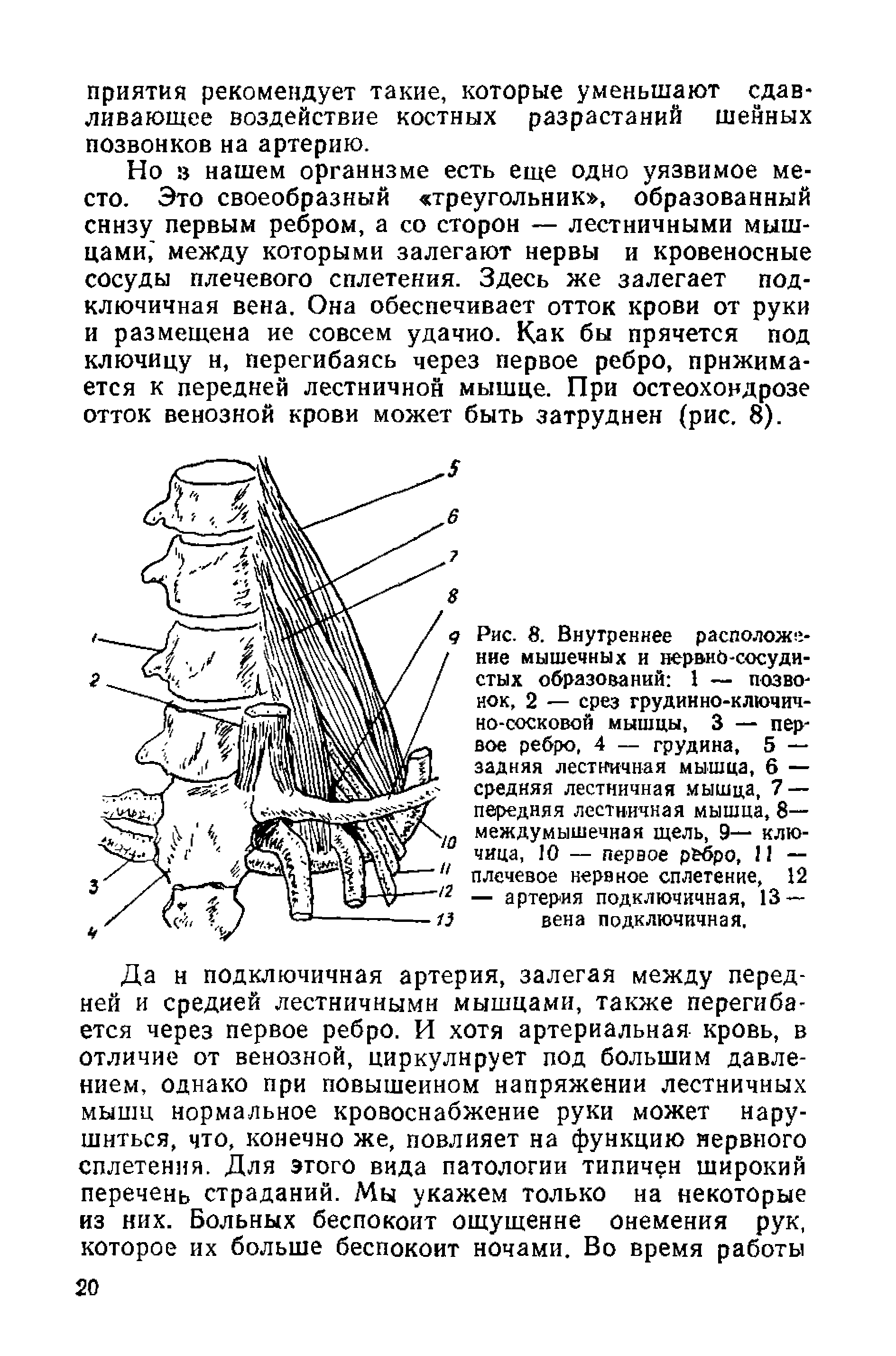 Рис. 8. Внутреннее расположение мышечных и нервно-сосудистых образований 1 — позвонок, 2 — срез грудинно-ключично-сосковой мышцы, 3 — первое ребро, 4 — грудина, 5 — задняя лестничная мышца, 6 — средняя лестничная мышца, 7 — передняя лестничная мышца, 8— междумышечная щель, 9— ключица, 10 — первое р бро, 11 — плечевое нервное сплетение, 12 — артерия подключичная, 13 — вена подключичная.