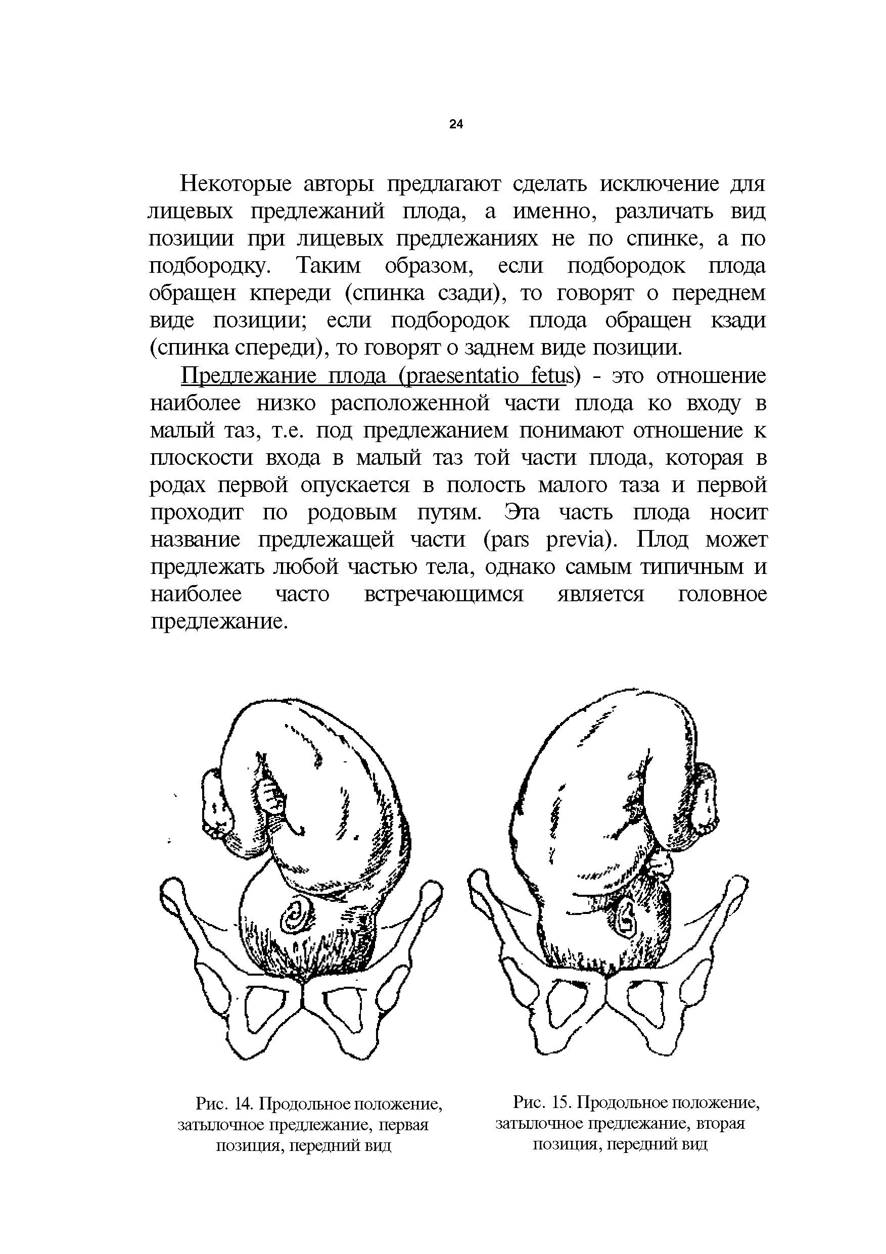 Рис. 15. Продольное положение, затылочное предлежание, вторая позиция, передний вид...