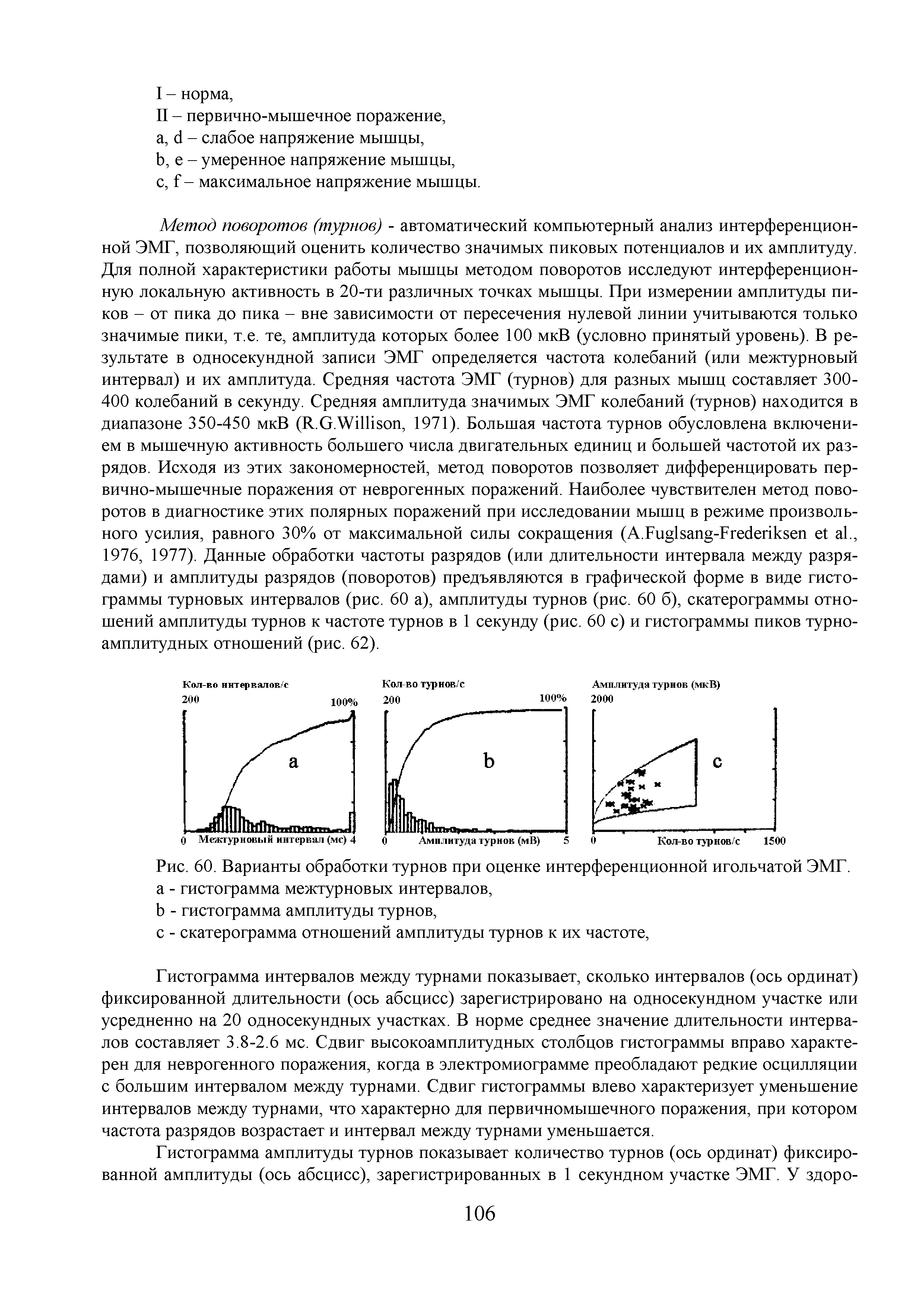 Рис. 60. Варианты обработки турнов при оценке интерференционной игольчатой ЭМГ. а - гистограмма межтурновых интервалов,...