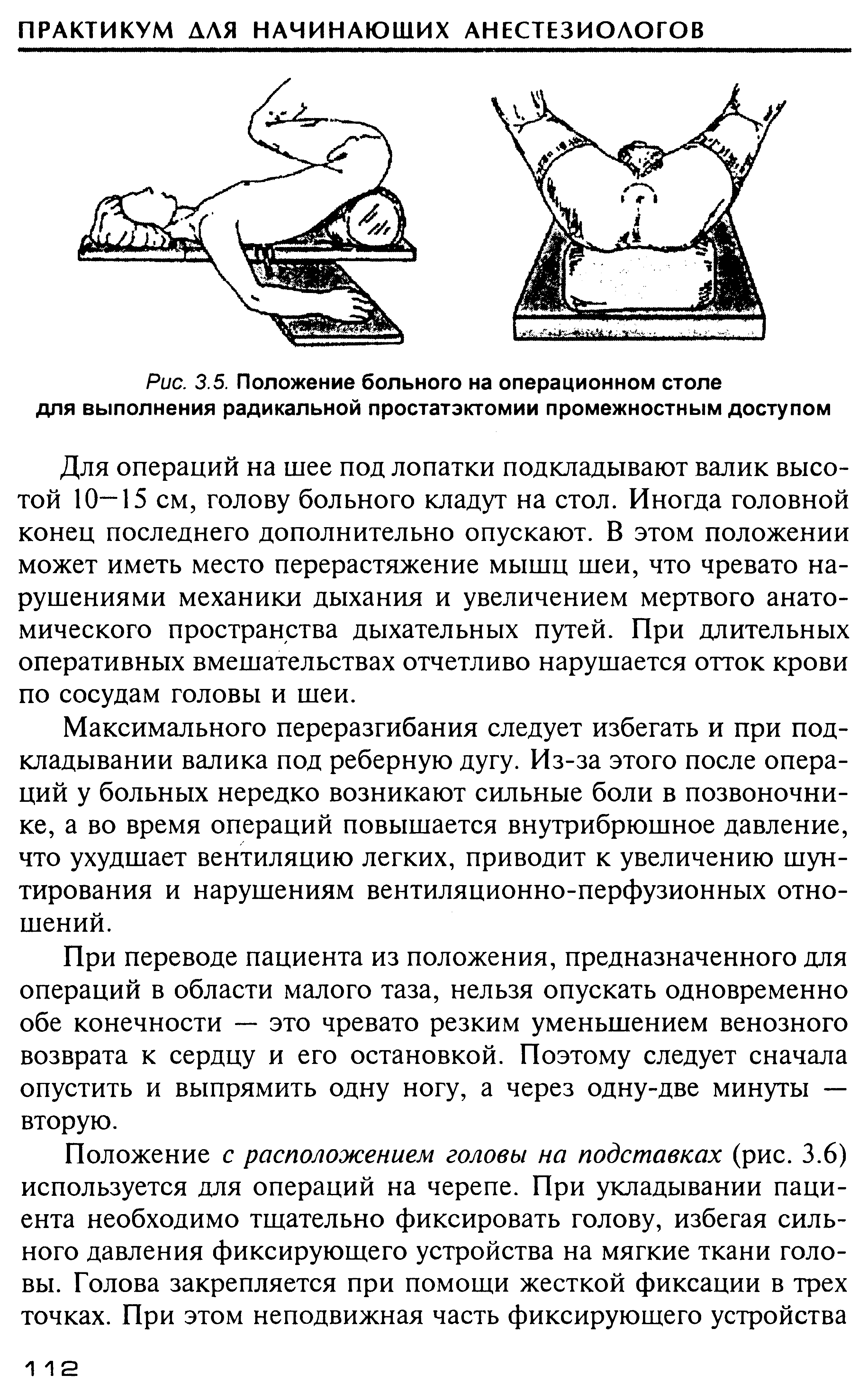 Рис. 3.5. Положение больного на операционном столе для выполнения радикальной простатэктомии промежностным доступом...