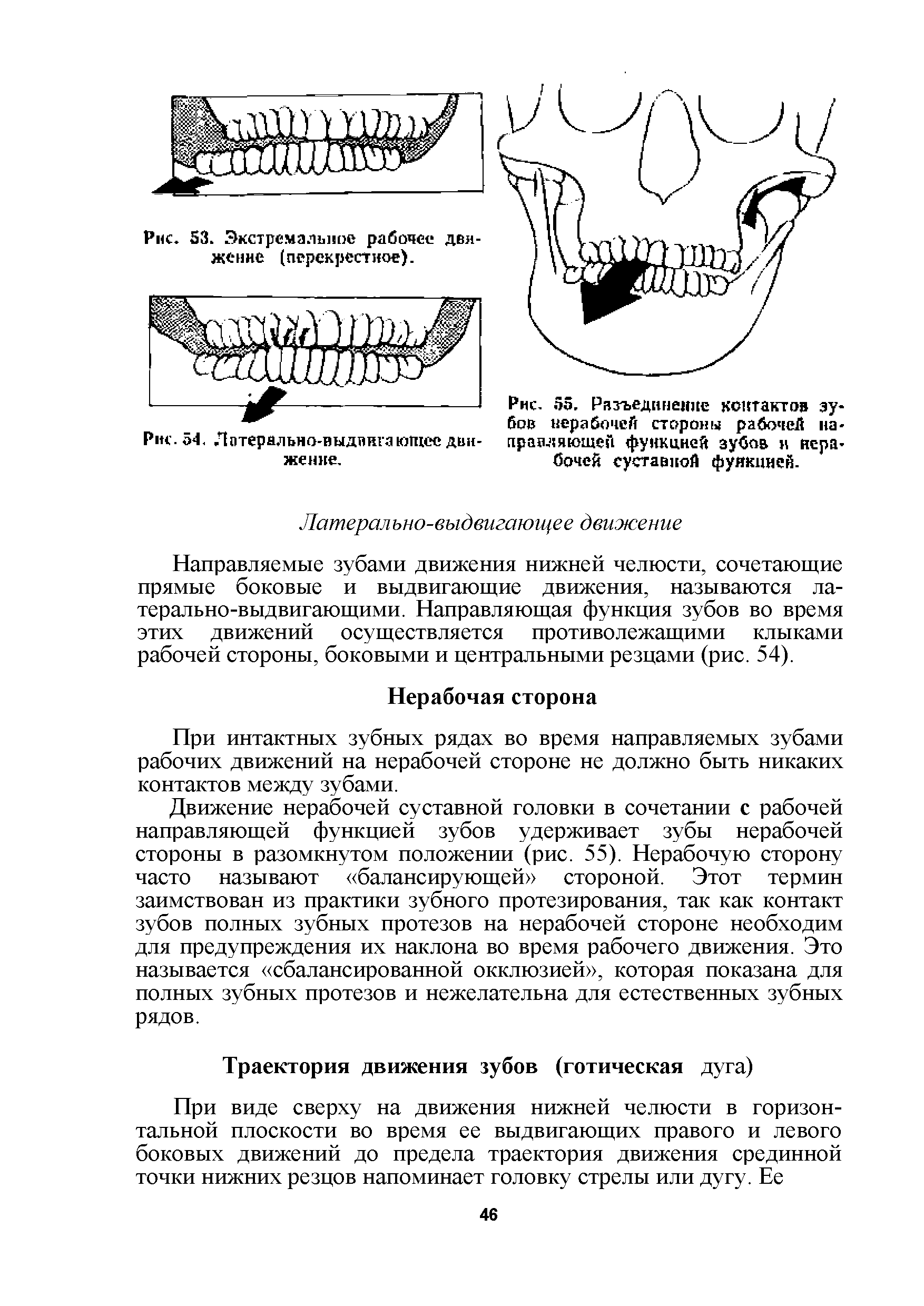 Рис. 55. Разъединение контактов зубов нерабочей стороны рабочей направляющей функцией зубов н нерабочей суставной функцией.