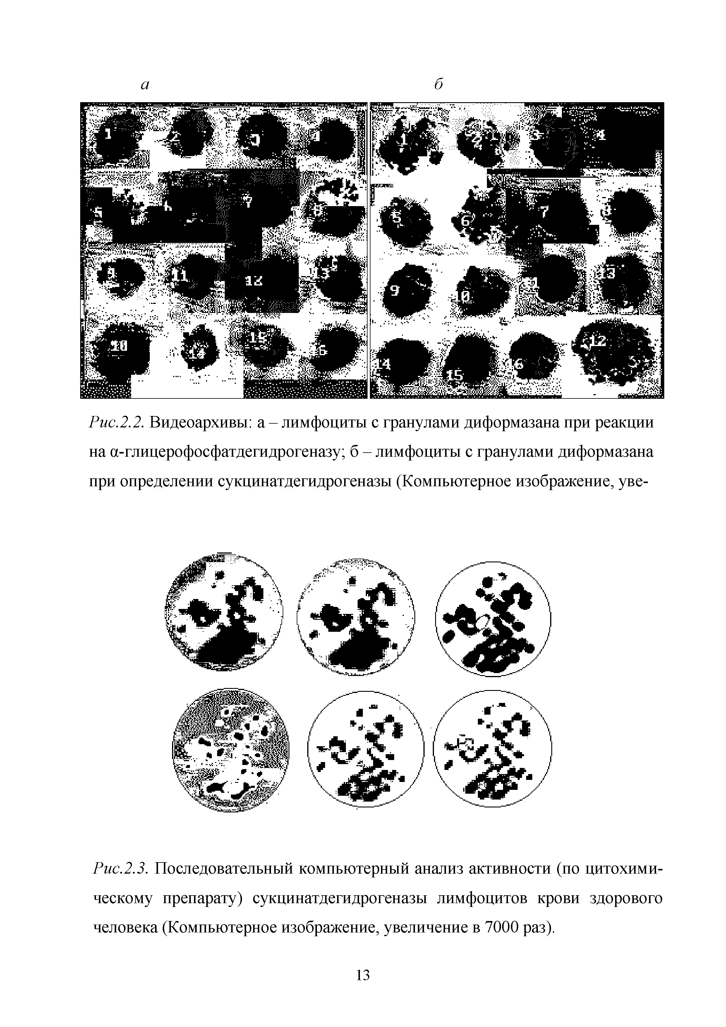 Рис.2.2. Видеоархивы а - лимфоциты с гранулами диформазана при реакции на а-глицерофосфатдегидрогеназу б - лимфоциты с гранулами диформазана при определении сукцинатдегидрогеназы (Компьютерное изображение, уве-...