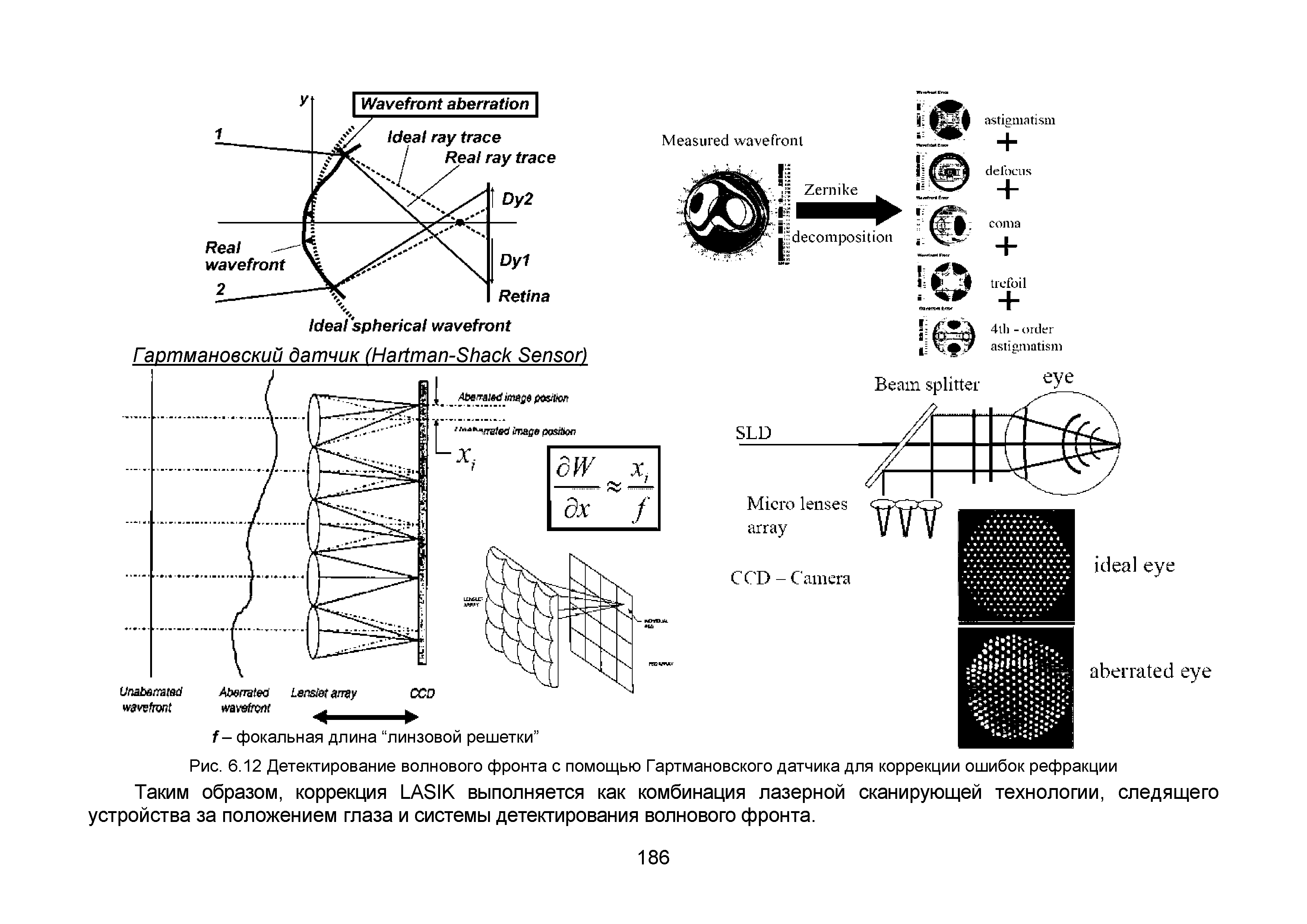 Рис. 6.12 Детектирование волнового фронта с помощью Гартмановского датчика для коррекции ошибок рефракции...