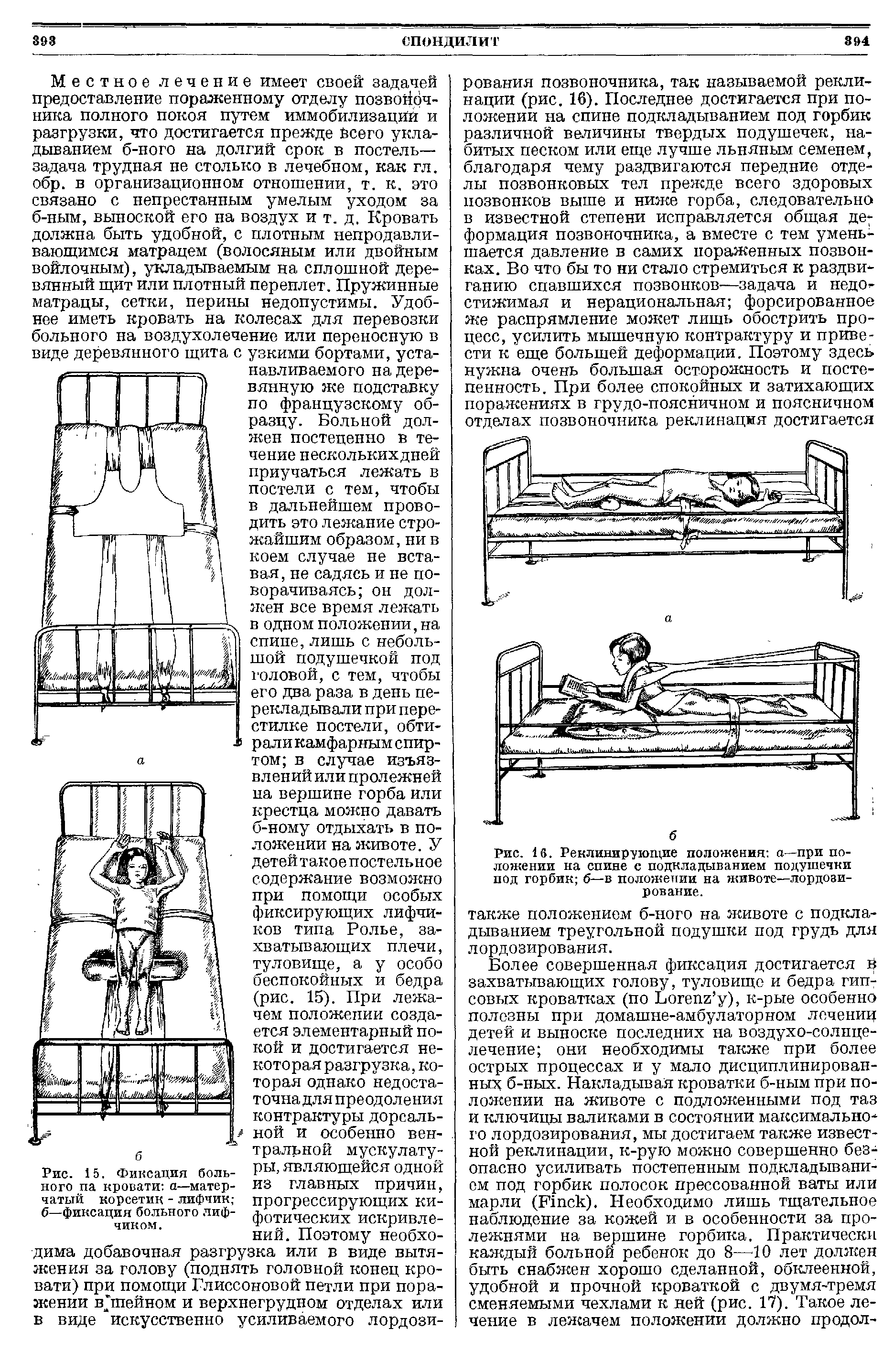 Рис. 15. Фиксация больного па кровати а—матерчатый корсетик - лифчик б—фиксация больного лифчиком.