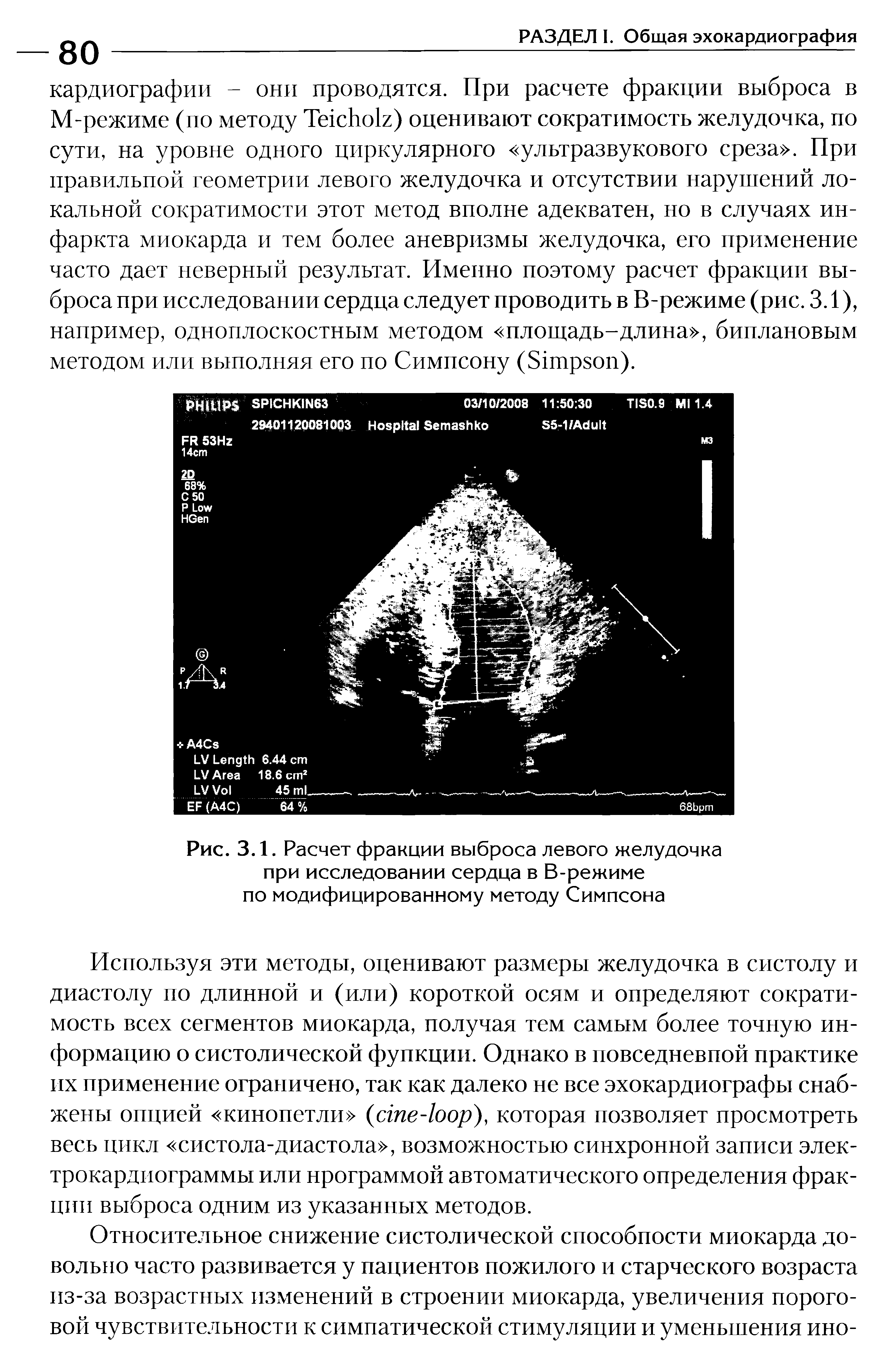 Рис. 3.1. Расчет фракции выброса левого желудочка при исследовании сердца в В-режиме по модифицированному методу Симпсона...