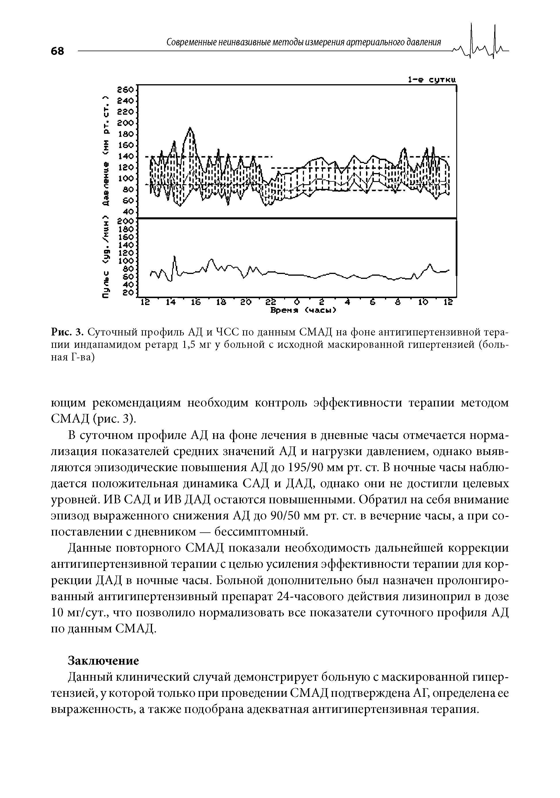 Рис. 3. Суточный профиль АД и ЧСС по данным СМАД на фоне антигипертензивной терапии индапамидом ретард 1,5 мг у больной с исходной маскированной гипертензией (больная Г-ва)...