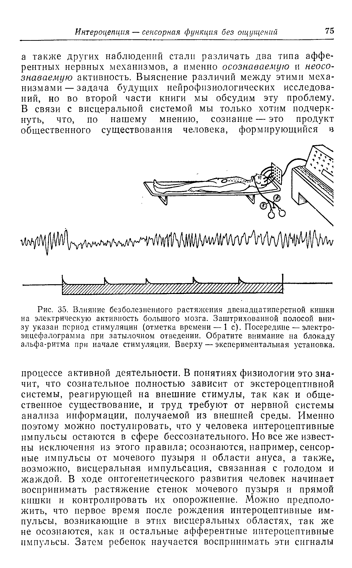 Рис. 35. Влияние безболезненного растяжения двенадцатиперстной кишки на электрическую активность большого мозга. Заштрихованной полосой внизу указан период стимуляции (отметка времени — 1 с). Посередине — электроэнцефалограмма при затылочном отведении. Обратите внимание на блокаду альфа-ритма при начале стимуляции. Вверху — экспериментальная установка.