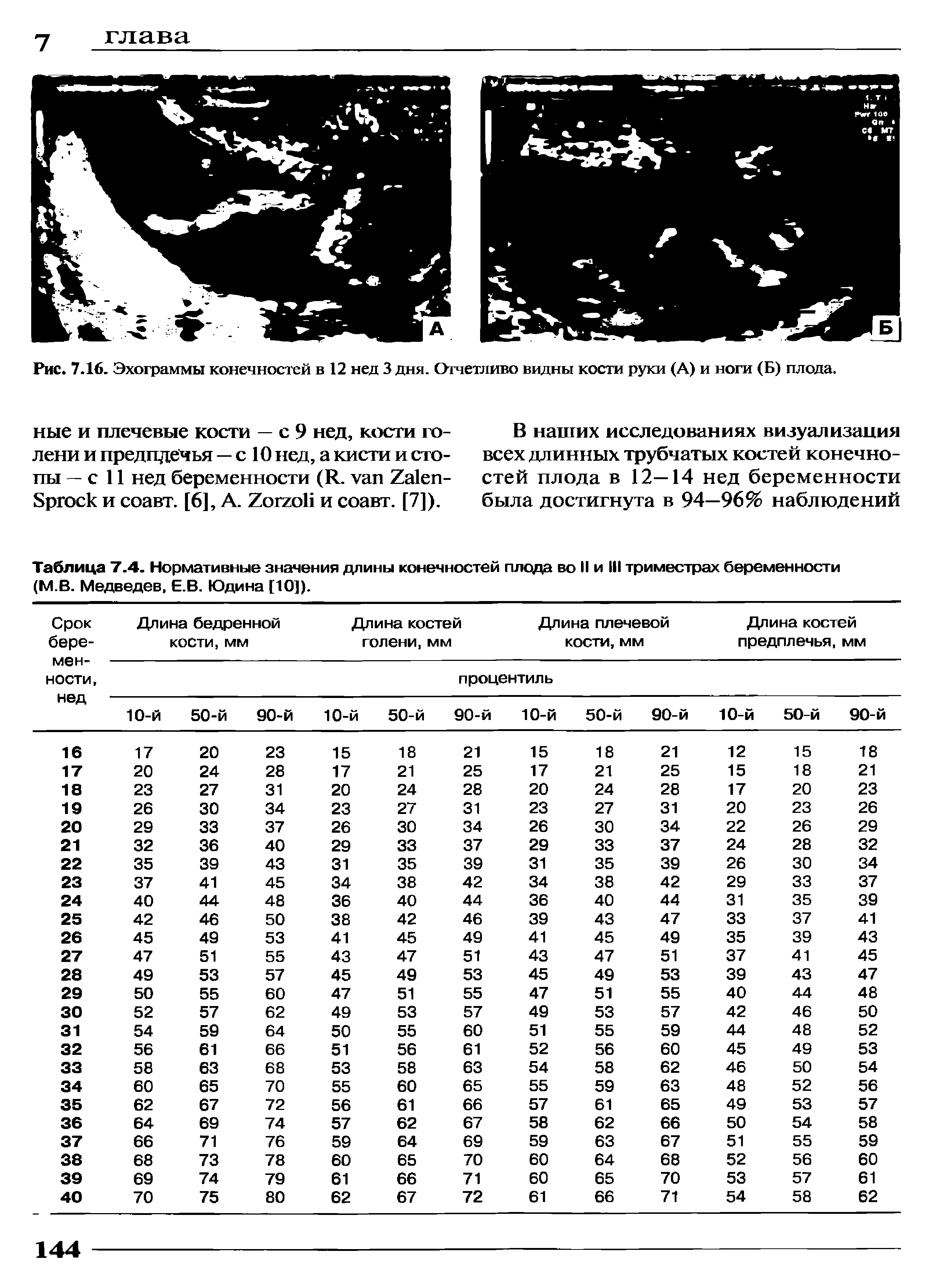 Таблица 7.4. Нормативные значения длины конечностей плода во II и III триместрах беременности (М.В. Медведев, Е.В. Юдина [10]).