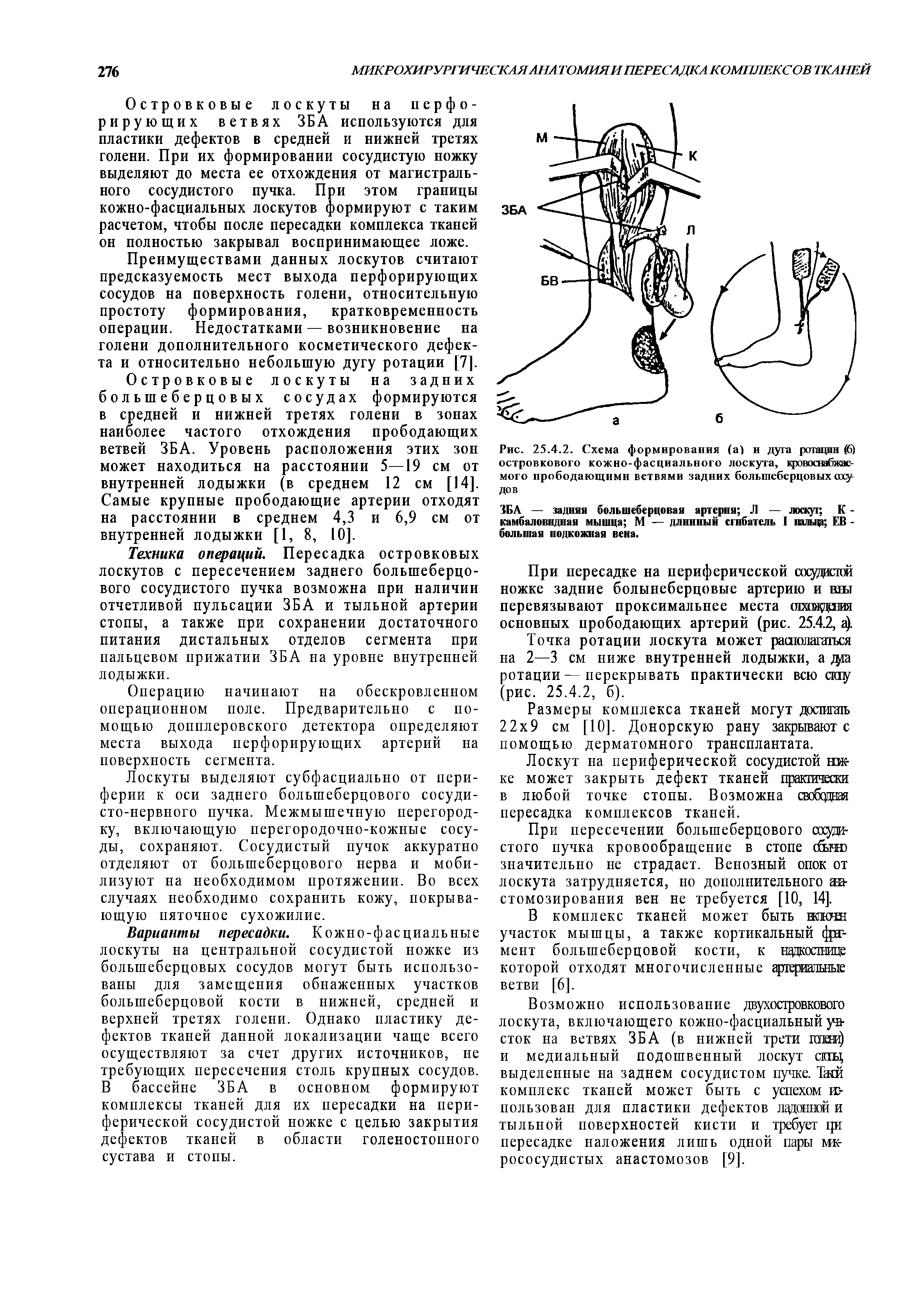 Рис. 25.4.2. Схема формирования (а) и дуга ротации (6) островкового кожно-фасциального лоскута, кровосвабжае-мого прободающими ветвями задних большеберцовых сосу ДО в...