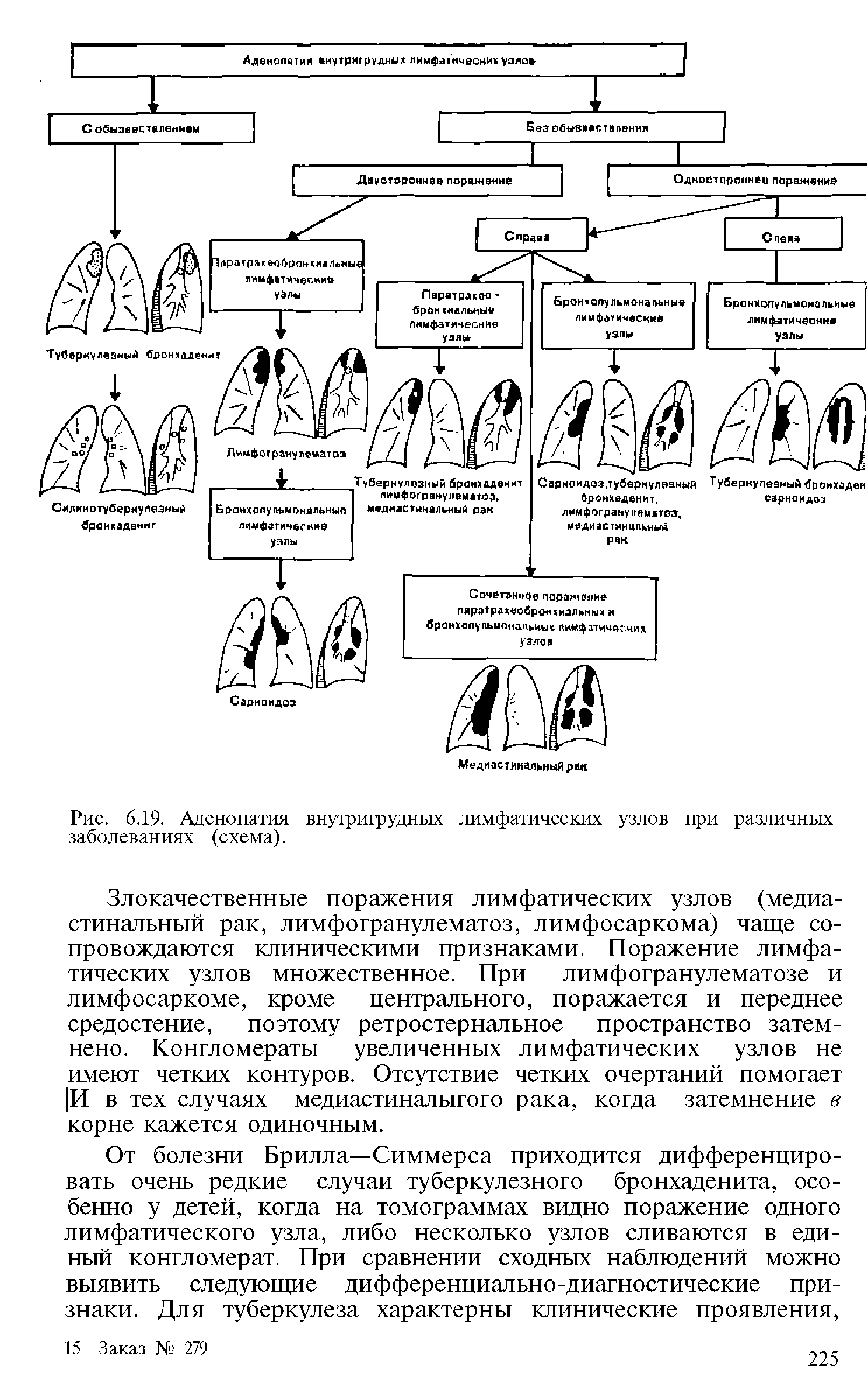 Рис. 6.19. Аденопатия внутригрудных лимфатических узлов при различных заболеваниях (схема).