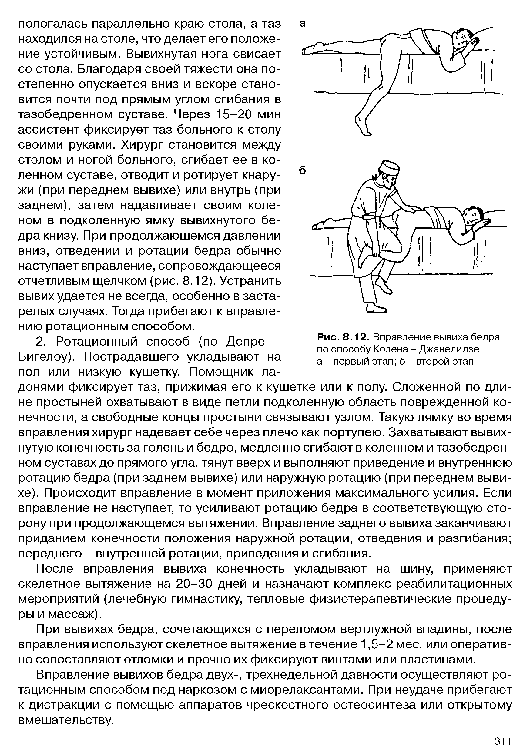 Рис. 8.12. Вправление вывиха бедра по способу Колена - Джанелидзе а - первый этап б - второй этап...