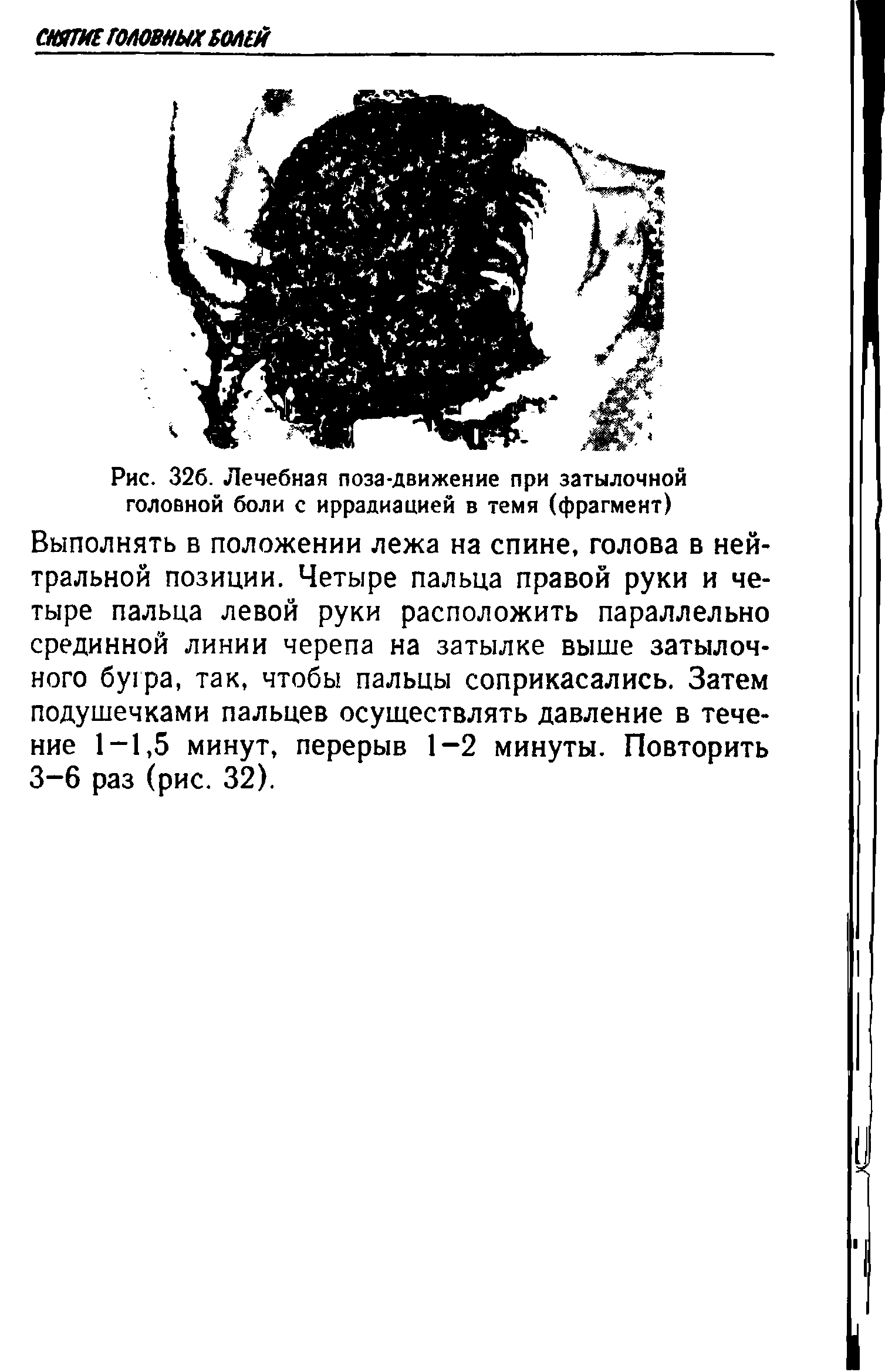 Рис. 326. Лечебная поза-движение при затылочной головной боли с иррадиацией в темя (фрагмент) Выполнять в положении лежа на спине, голова в нейтральной позиции. Четыре пальца правой руки и четыре пальца левой руки расположить параллельно срединной линии черепа на затылке выше затылочного бугра, так, чтобы пальцы соприкасались. Затем подушечками пальцев осуществлять давление в течение 1-1,5 минут, перерыв 1-2 минуты. Повторить 3-6 раз (рис. 32).