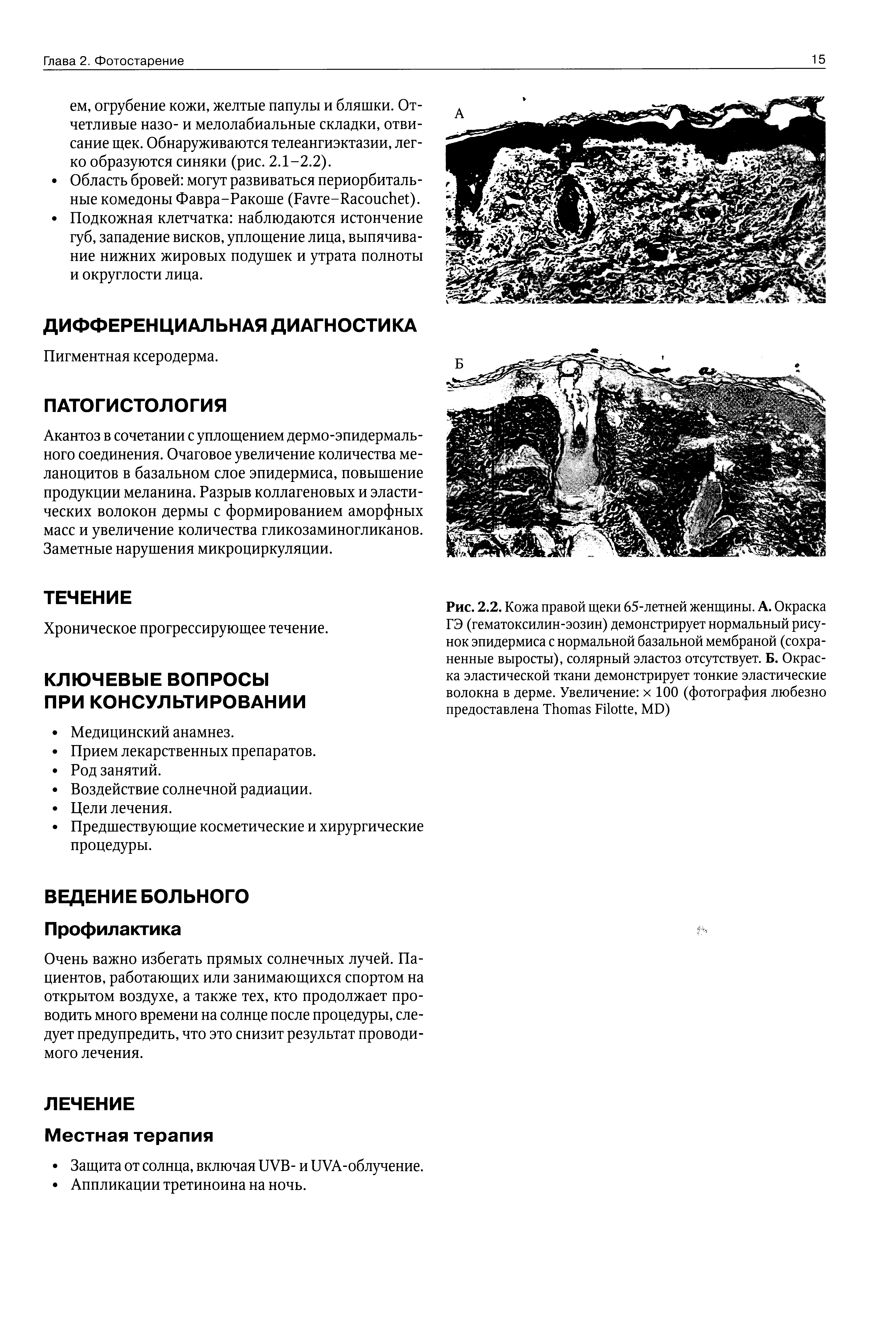 Рис. 2.2. Кожа правой щеки 65-летней женщины. А. Окраска ГЭ (гематоксилин-эозин) демонстрирует нормальный рисунок эпидермиса с нормальной базальной мембраной (сохраненные выросты), солярный эластоз отсутствует. Б. Окраска эластической ткани демонстрирует тонкие эластические волокна в дерме. Увеличение х 100 (фотография любезно предоставлена T F , MD)...