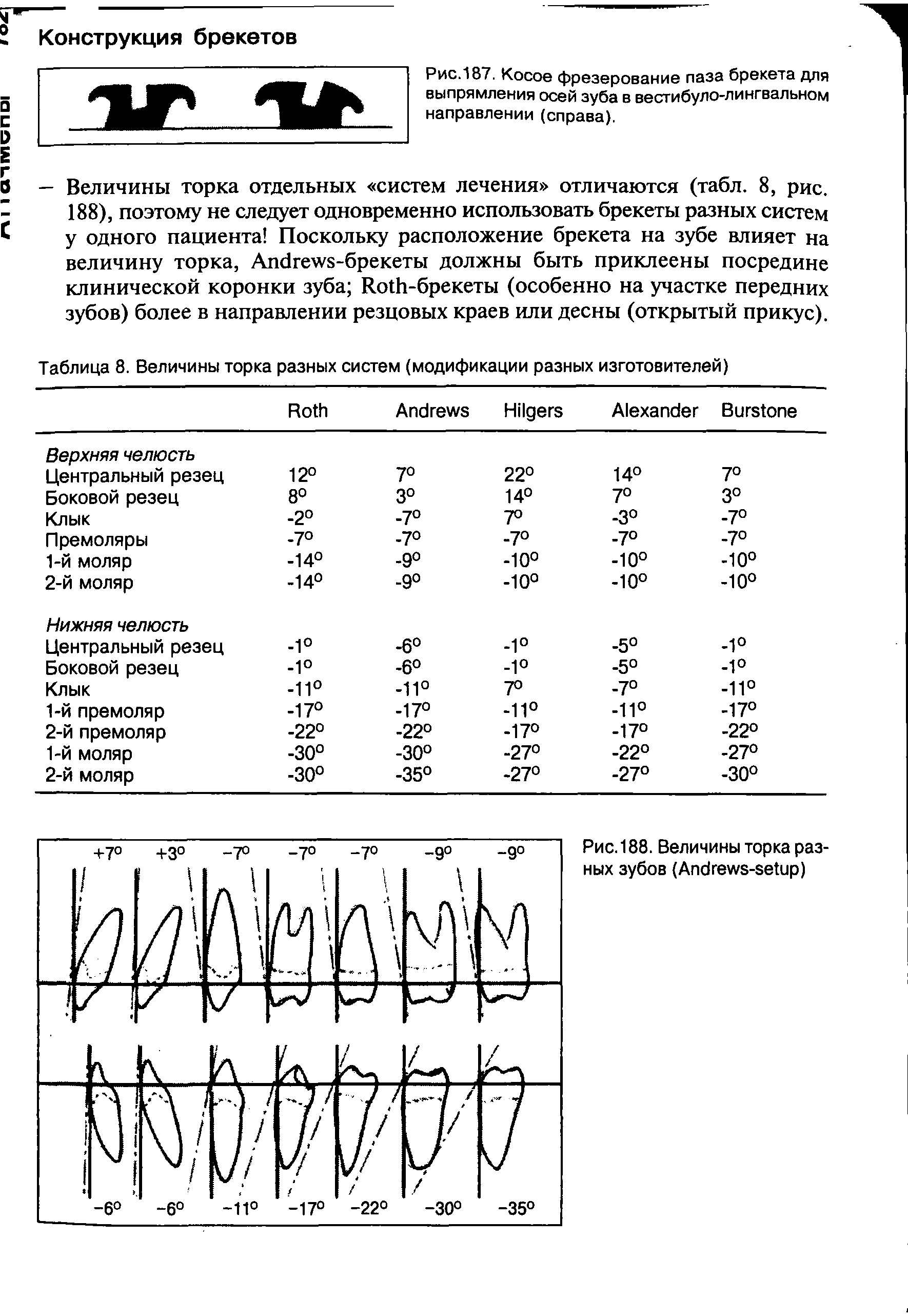 Рис. 188. Величины торка разных зубов (A - )...