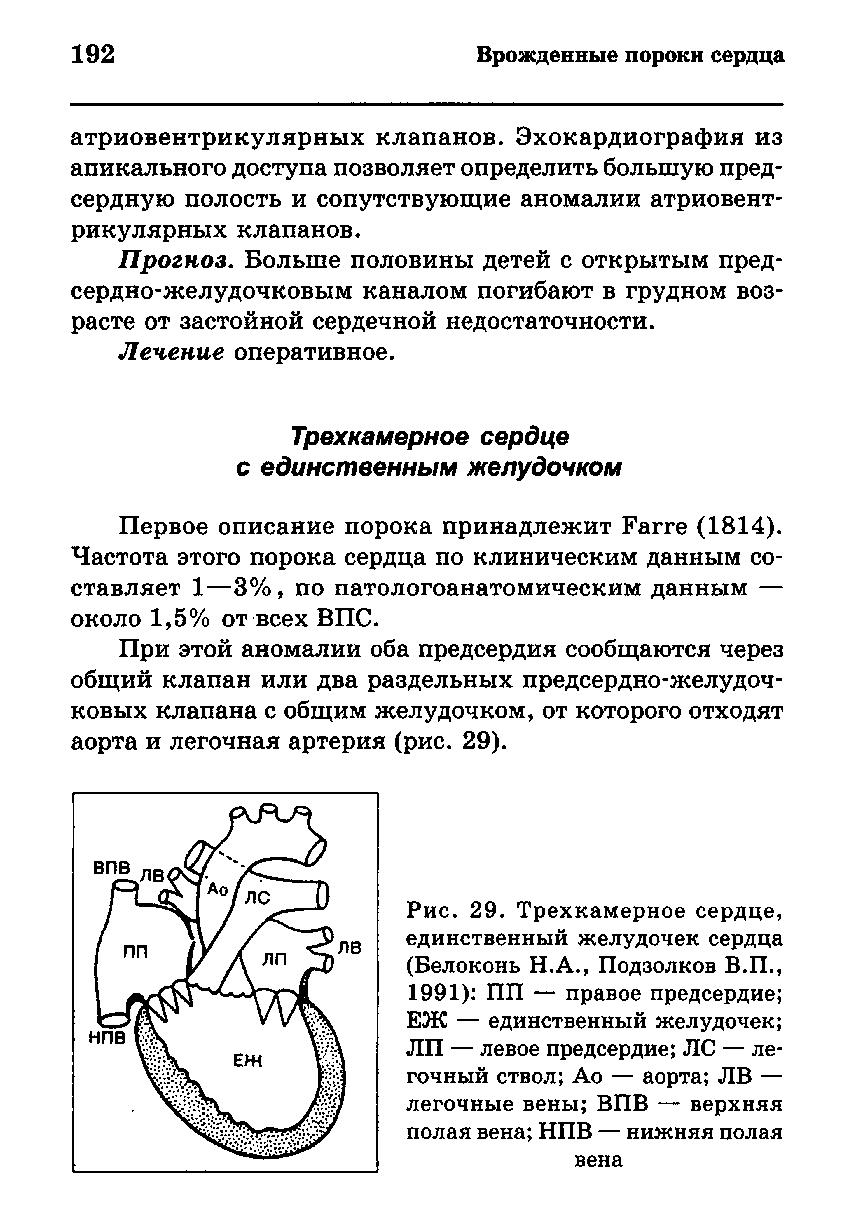 Рис. 29. Трехкамерное сердце, единственный желудочек сердца (Белоконь Н.А., Подзолков В.П., 1991) ПП — правое предсердие ЕЖ — единственный желудочек ЛП — левое предсердие Л С — легочный ствол Ао — аорта ЛВ — легочные вены ВПВ — верхняя полая вена НПВ — нижняя полая...