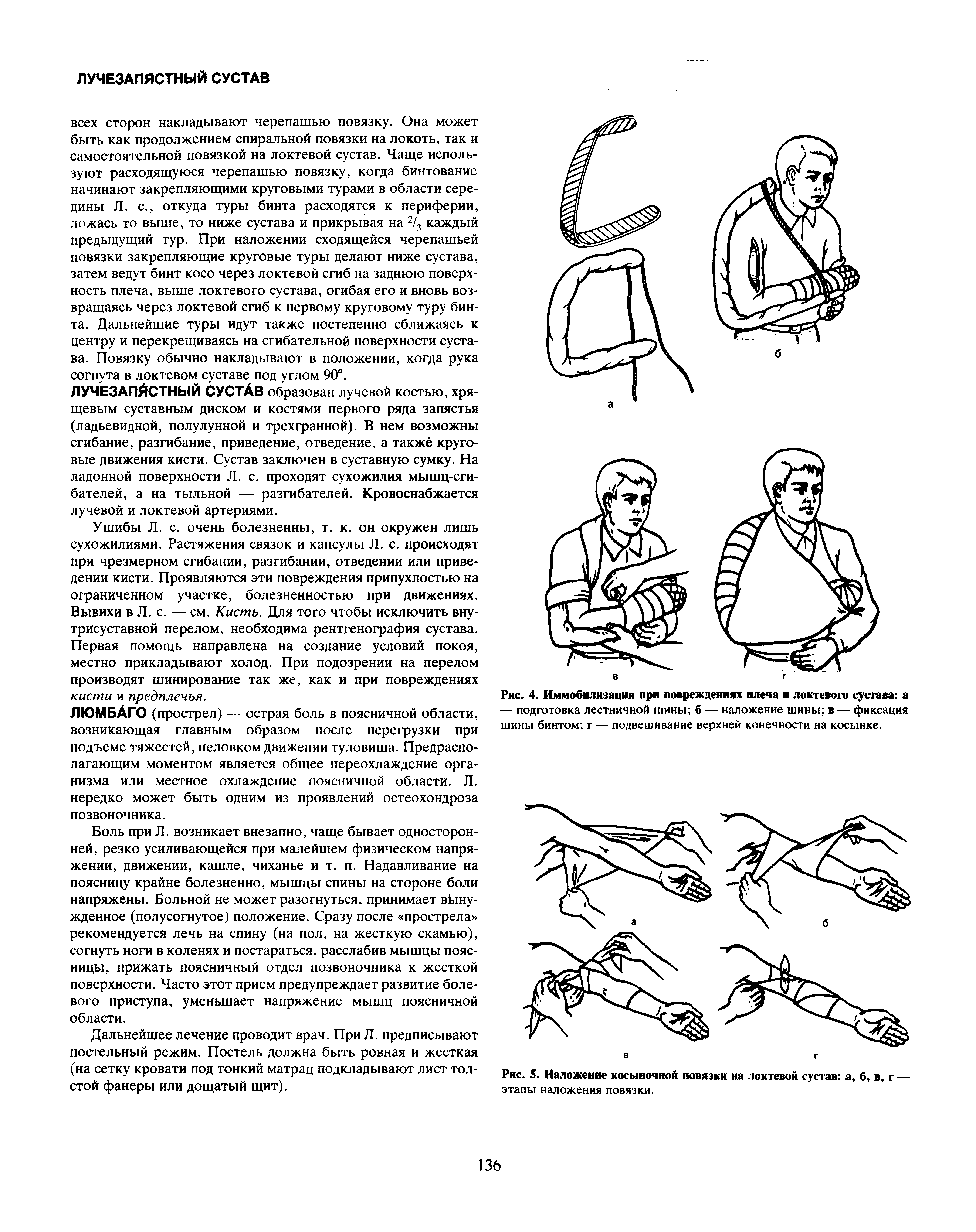 Рис. 5. Наложение косыночной повязки на локтевой сустав а, б, в, г — этапы наложения повязки.