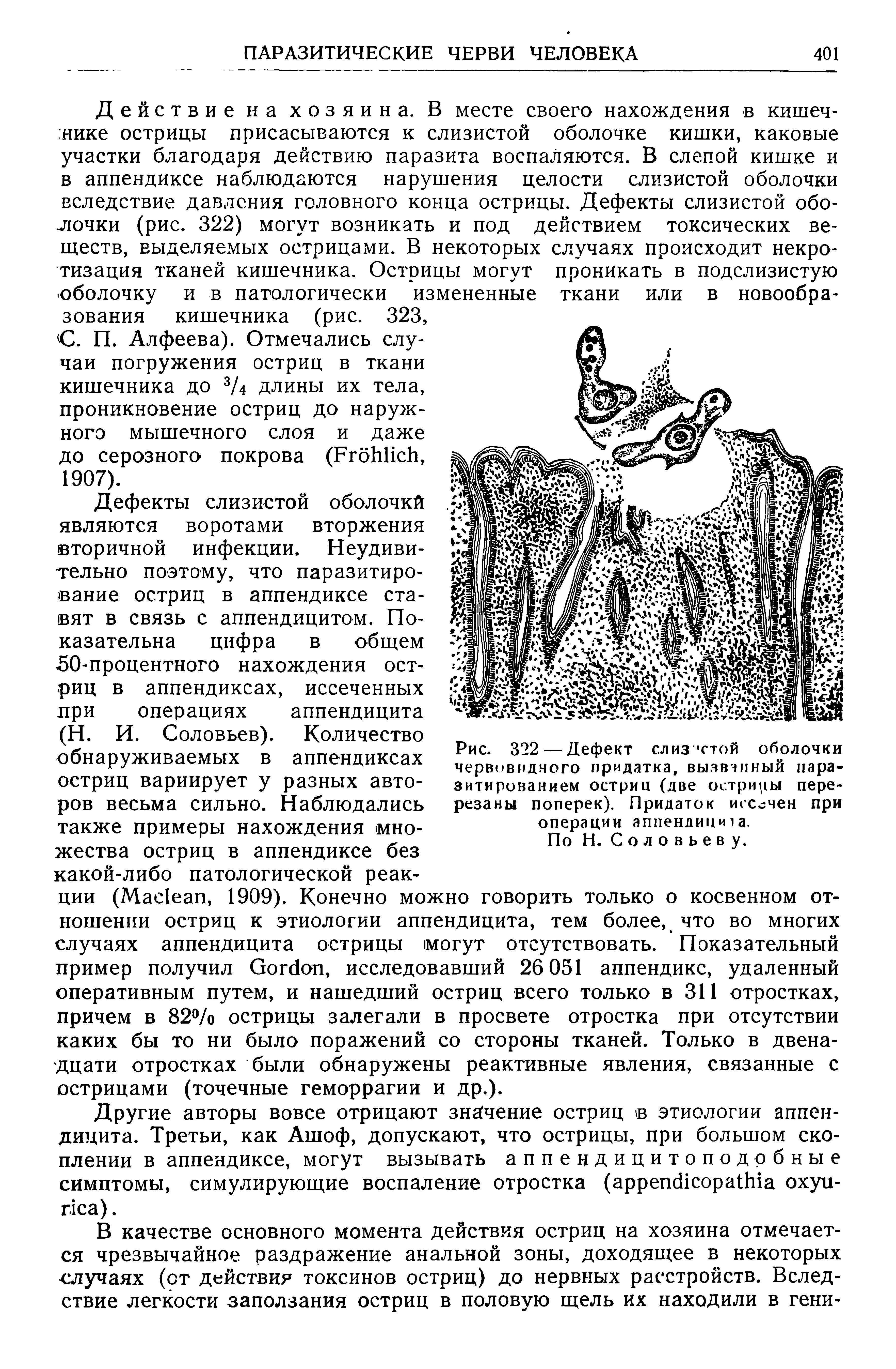 Рис. 322 — Дефект слиз стой оболочки червовидного придатка, вызванный паразитированием остриц (две острицы перерезаны поперек). Придаток иссечен при операции аппендицита. По Н. Соловьев у.