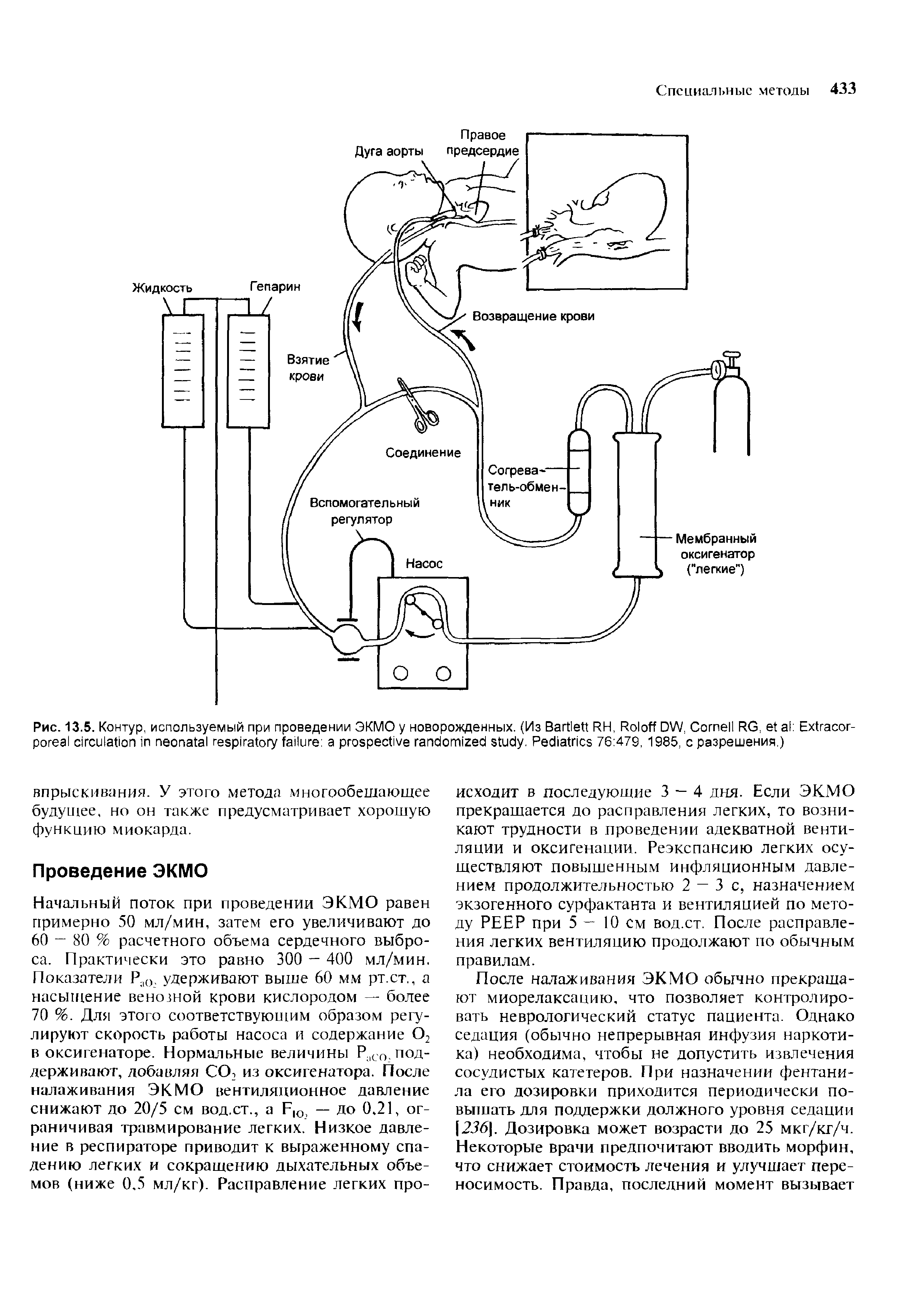 Рис. 13.5. Контур, используемый при проведении ЭКМО у новорожденных. (Из B RH, R DW, C RG, E . P 76 479, 1985, с разрешения.)...