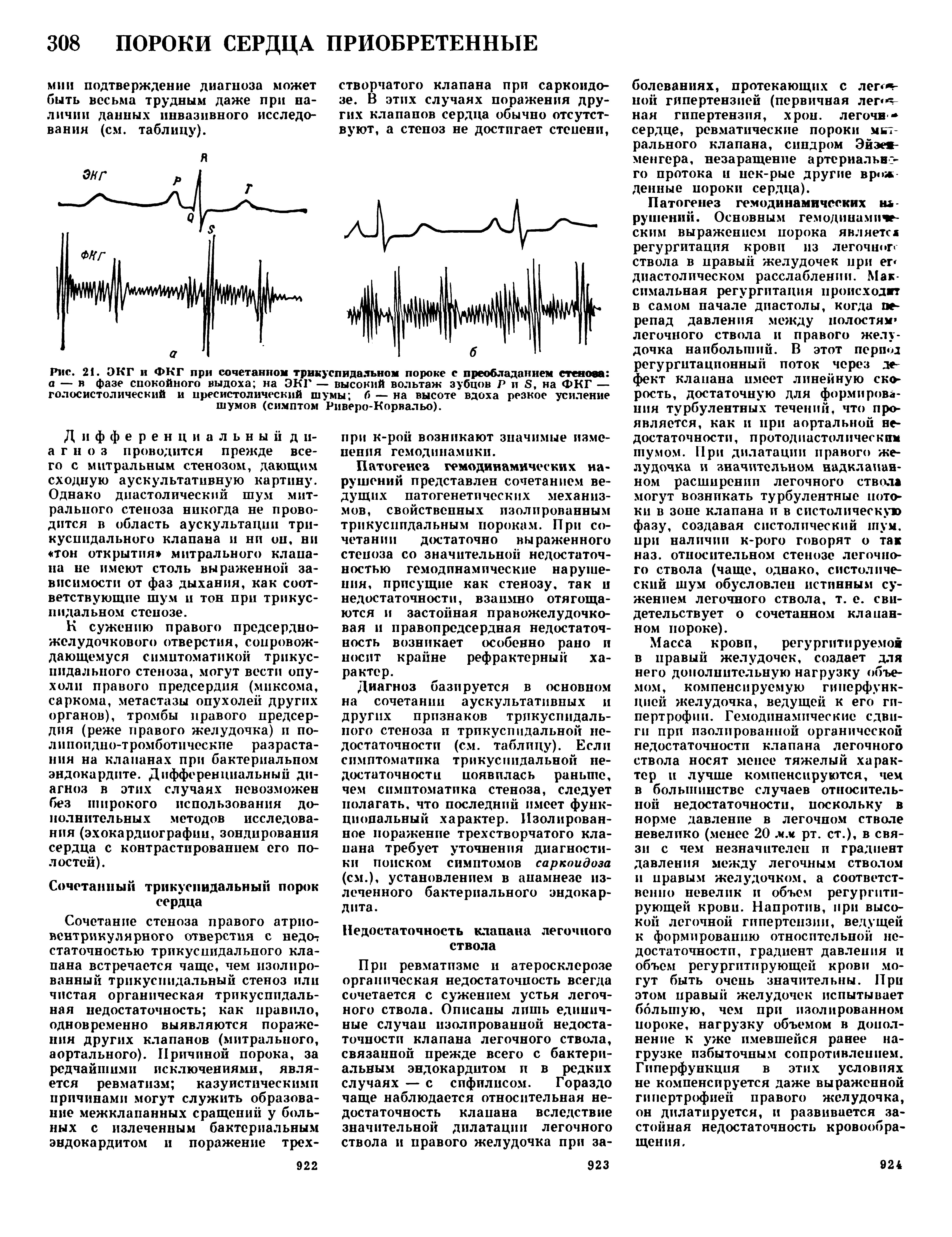 Рис. 21. ЭКГ и ФКГ при сочетанном трикуспидальном пороке с преобладанием стенова а — в фазе спокойного выдоха на ЭКГ — высокий вольтаж зубцов Р и в, на ФКГ — голосистолический и пресистолический шумы б — на высоте вдоха резкое усиление шумов (симптом Риверо-Корвальо).