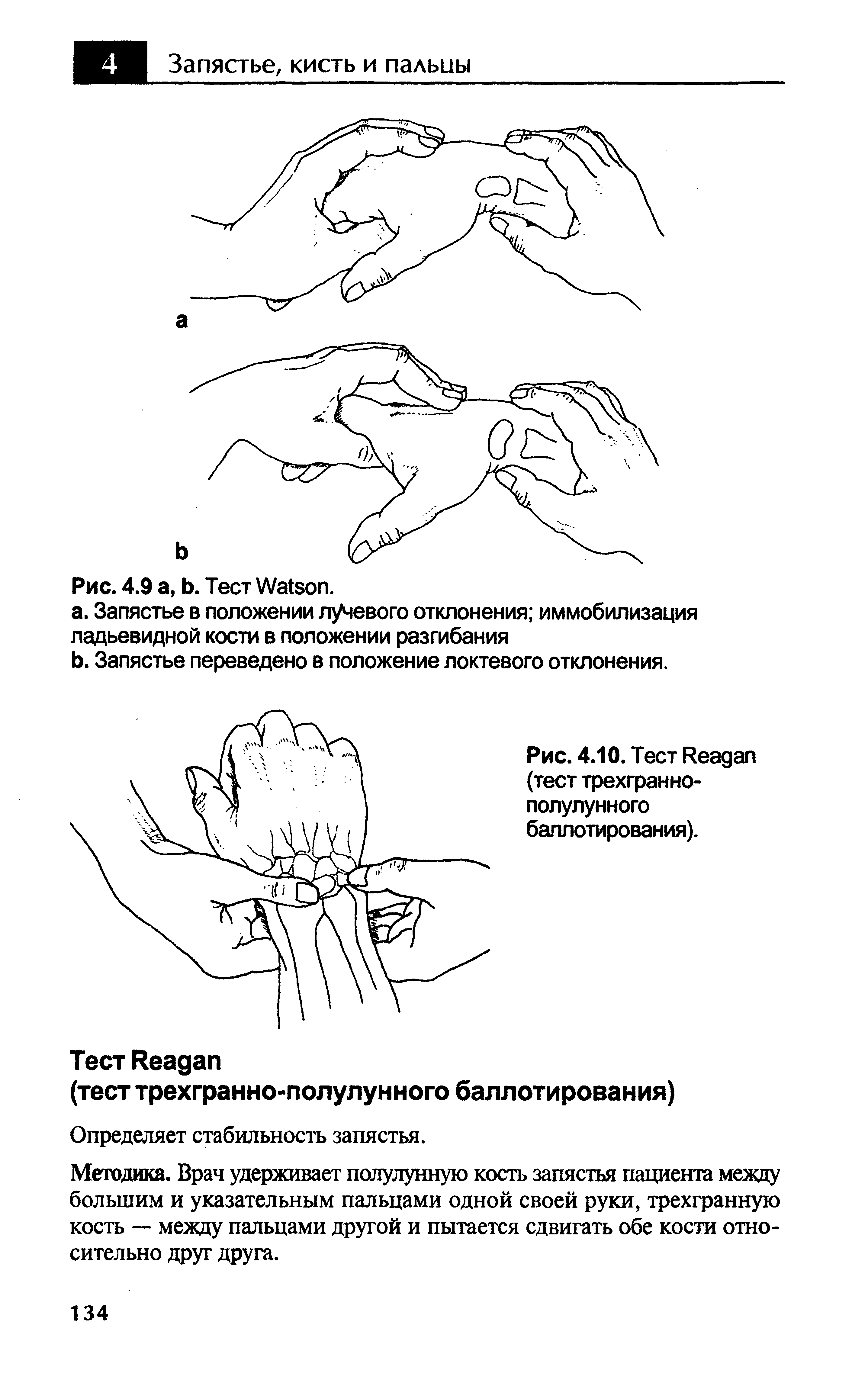 Рис. 4.10. Тест R (тест трехгранно-полулунного баллотирования).